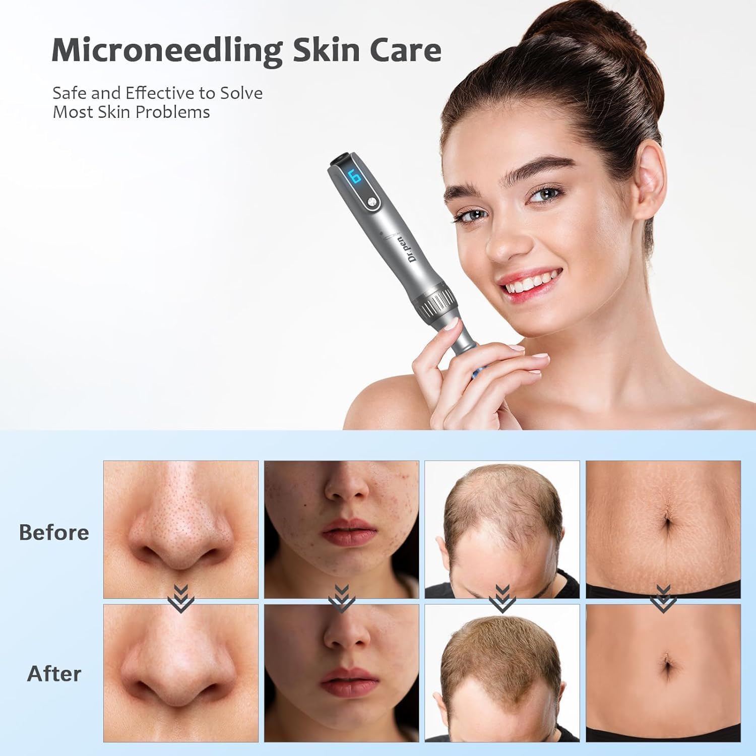 Dr.pen Ultima M8S Microneedling Pen – Kit de Derma Pen Inalámbrico con 20 Cartuchos de Repuesto