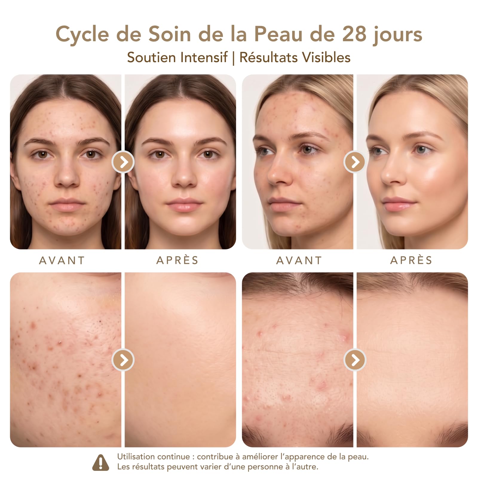 Dr. Pen M9 Stylo Microneedling Sans Fil | 4 Types de Cartouches Interchangeables | 6 Vitesses Réglables, 0–2.5mm Réglage de Profondeur, Batterie Rechargeable 700 mAh avec Station de Support