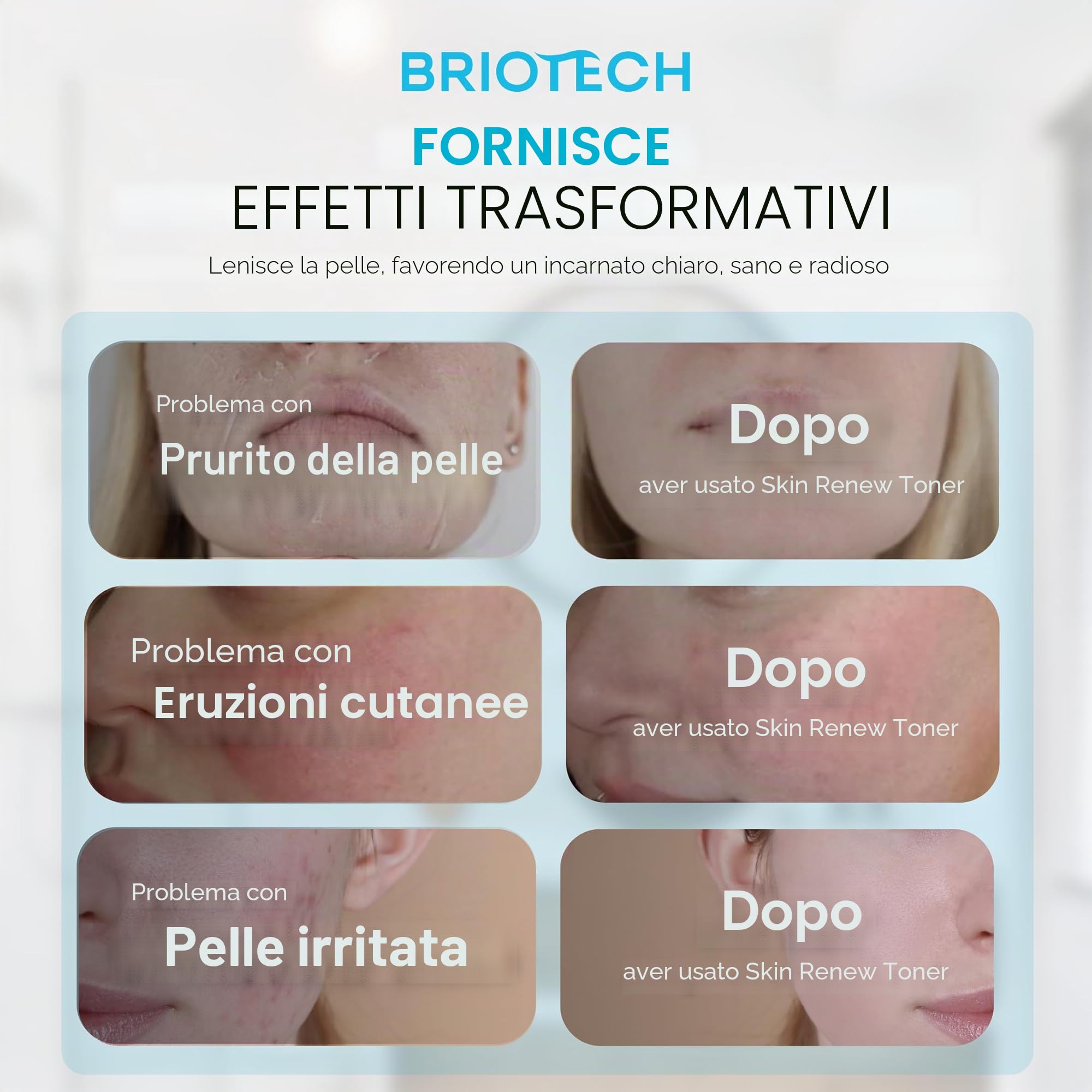 BRIOTECH Spray Toner per il viso - Acido Ipocloroso Puro HOCl - Nebbia Lenitiva per tutti i tipi di pelle - Skin Renew - 100