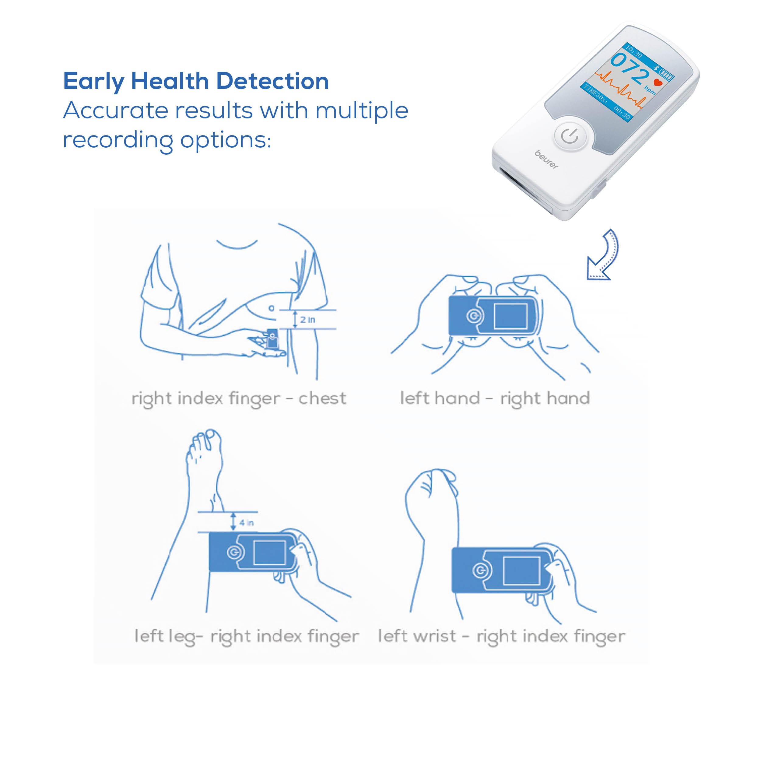 Beurer Cardio Companion EKG Monitor - 3-Lead Portable ECG Machine, Detects Irregular Heart Rhythms, Fast Results in 30 Seconds, Bluetooth with App, Rechargeable Battery, FSA/HSA Eligible, ME75
