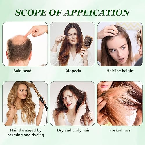 Miniatura 6 de Champú de aceite de batana para el crecimiento del cabello, champú de romero para adelgazar el cabello, nutrir y regenerar el cabello, suave y