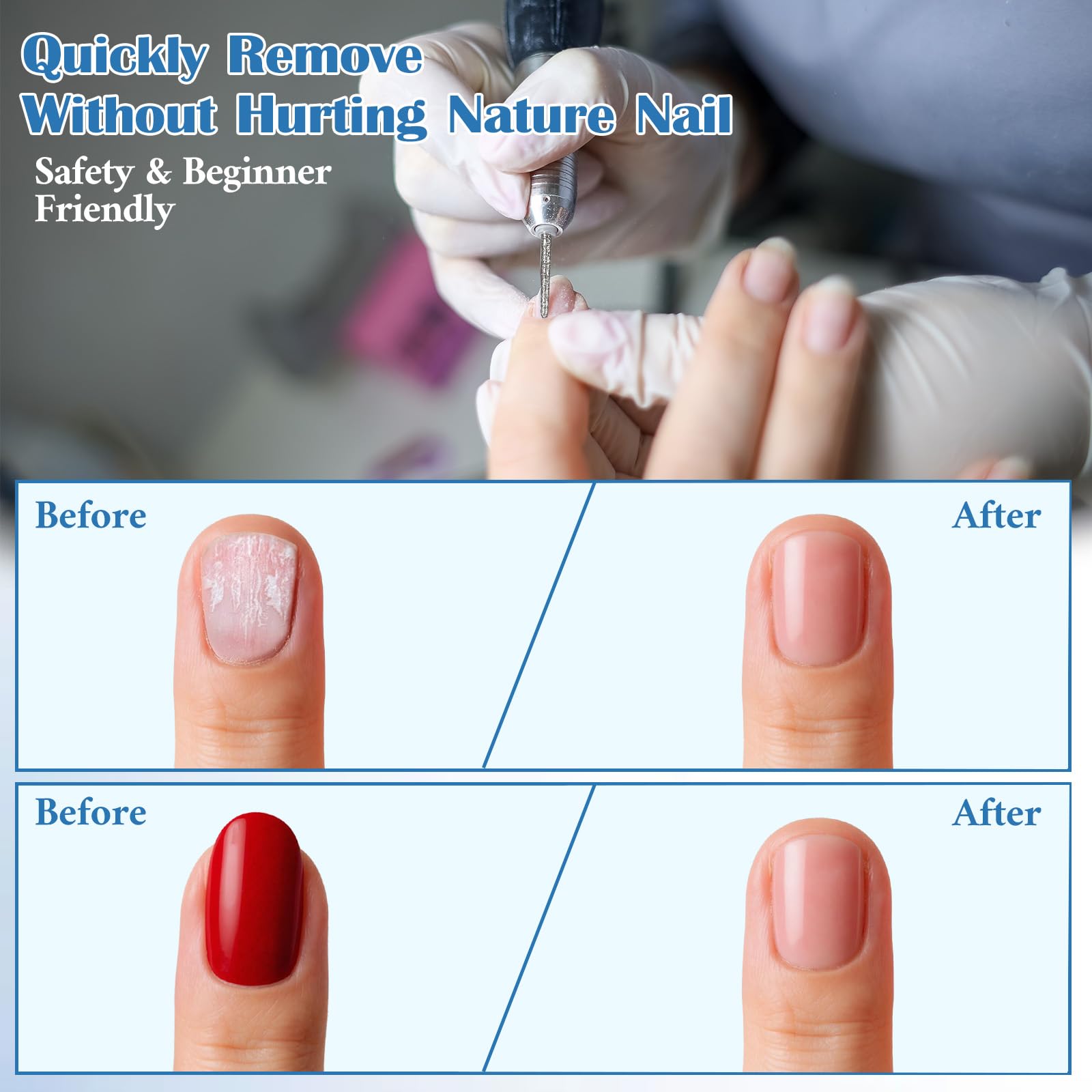 6 punte per cuticole, fresa per unghie riutilizzabili, con astuccio, fresa per cuticole diamantate, strumento professionale per la pulizia delle cuticole, grana media per la cura dei piedi