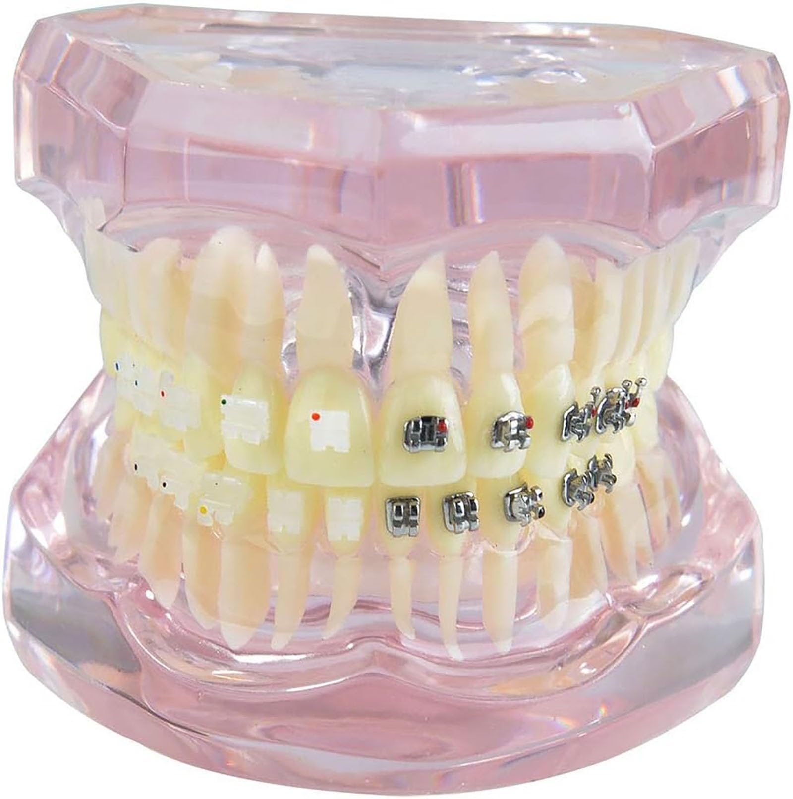 Modello di Dente, Apparecchio Dentale in Metallo E Ceramica Denti Modello, Modello Ortodontico per Adulti Dentale Denti Modello Dentista per Insegnamento di Scienze Studio Odontoiatria Strumenti per (