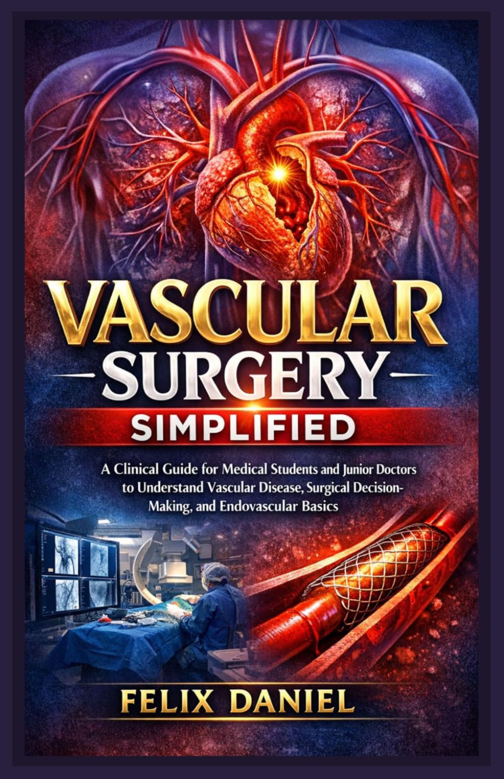 Vascular Surgery Simplified: A Clinical Guide for Medical Students and Junior Doctors to Understand Vascular Disease, Surgical Decision-Making, and Endovascular Basics