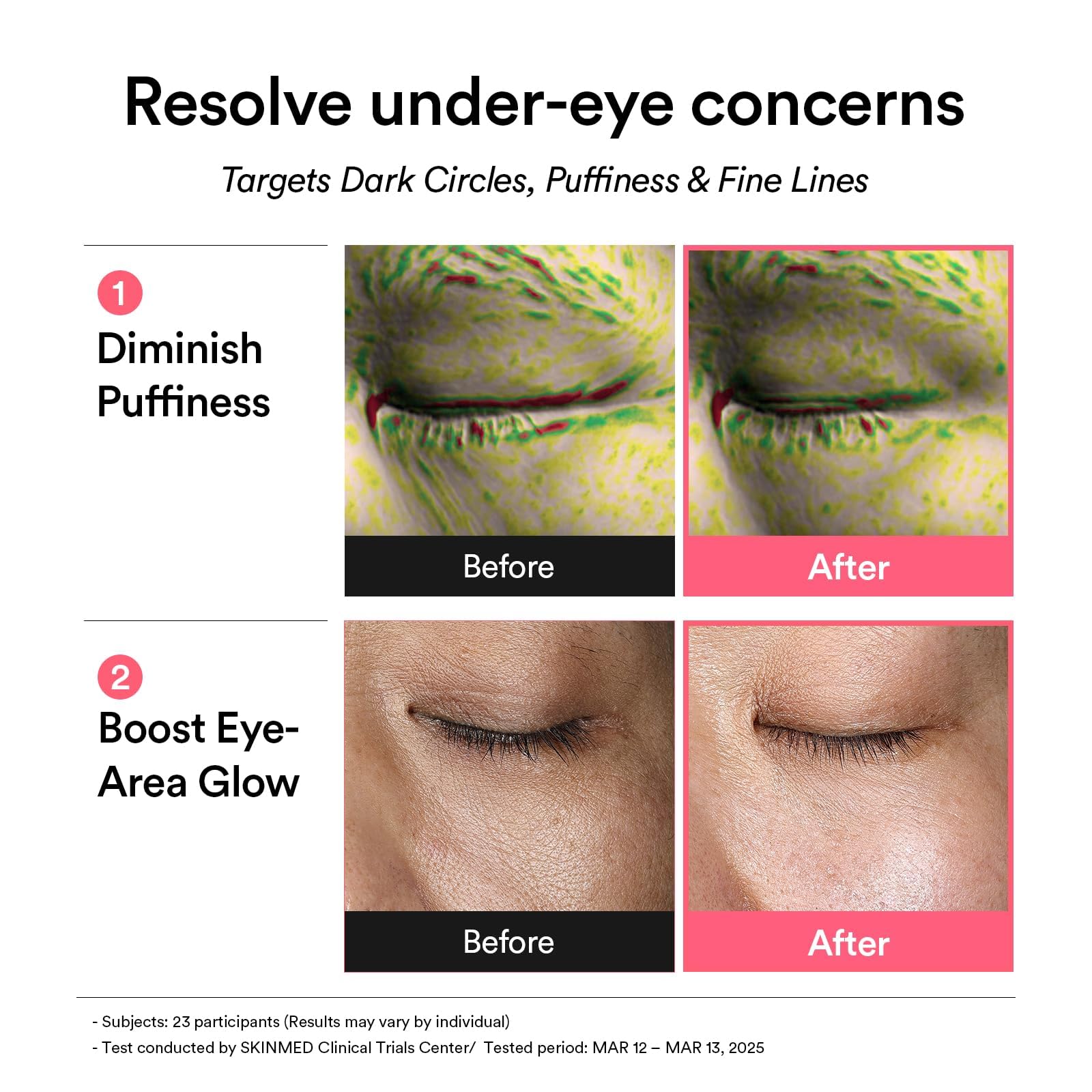 Abib Cerotti Per Gli Occhi Pdrn Retinal Eye Patch Glow Jelly Coreani Per Occhi Gonfi E Occhiaie, Antirughe, Collagene, Caffeina, Niacinamide 60 Cerotti,