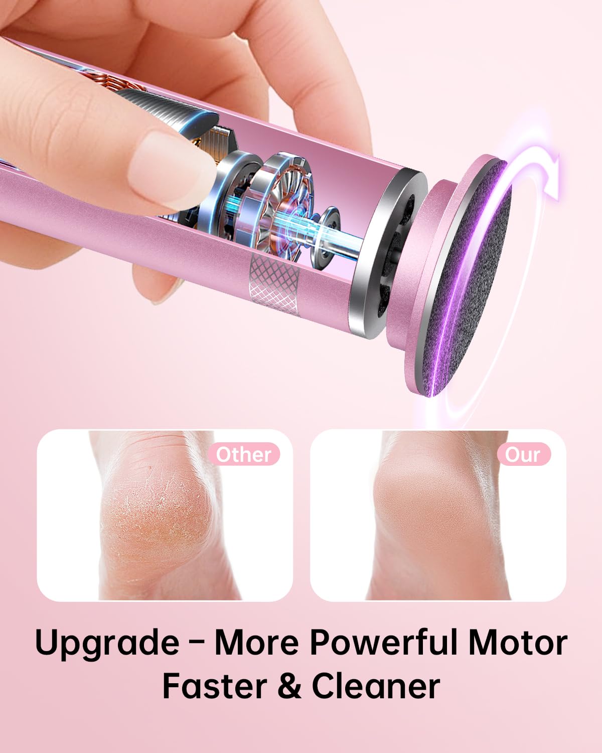 Electric Foot Callus Remover, Upgrade Electric Foot File Callus Remover for Feet, Adjustable Speed Foot File with 60 Pcs Sandpaper Discs, Foot Scrubber for Cracked, or Tough Skin and Calluses, Pink 2