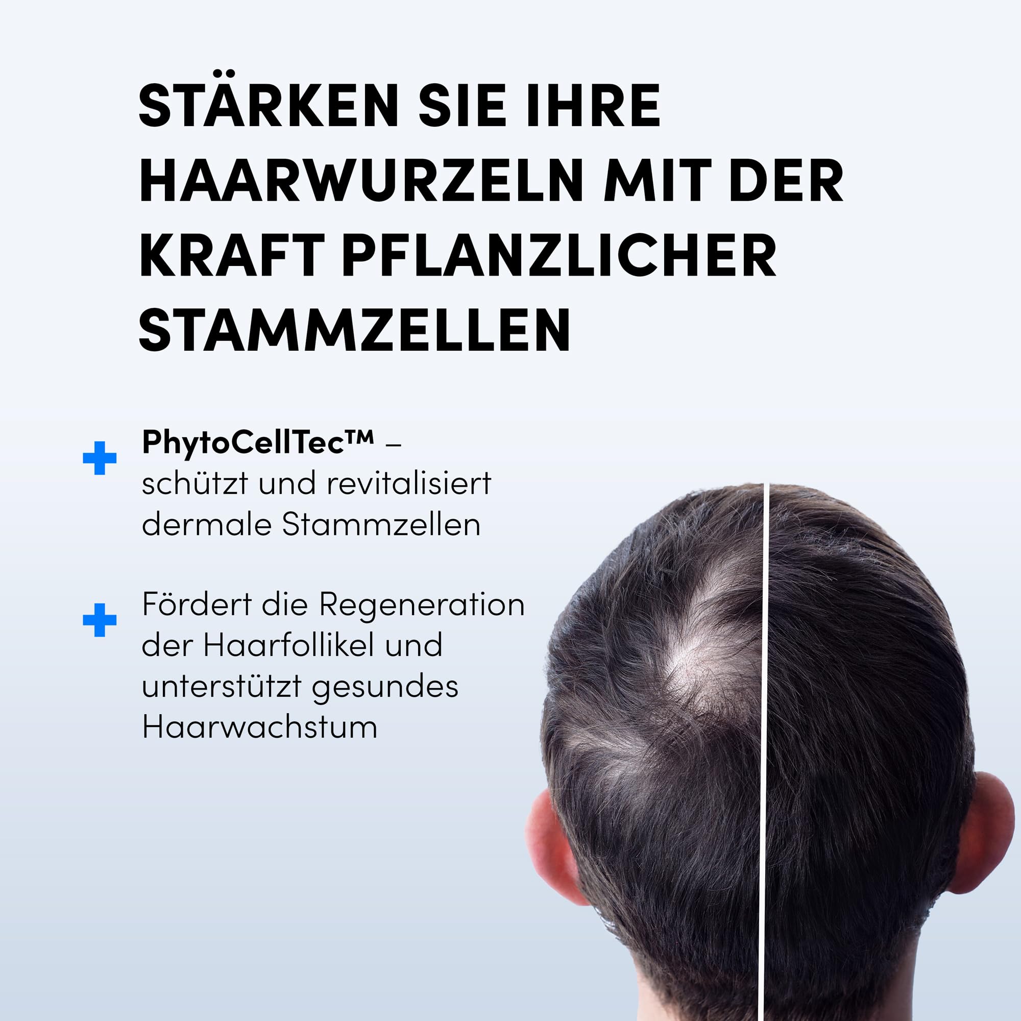 Dr. Balwi Microneedling-Roller & Hair Growth SerumSet – Anti Haarausfall, stärkt Haarwurzeln, fördert Haarwachstum mit Procapil & Stammzellen, ohne Silikone & Parabene, 10x6ml Flacon