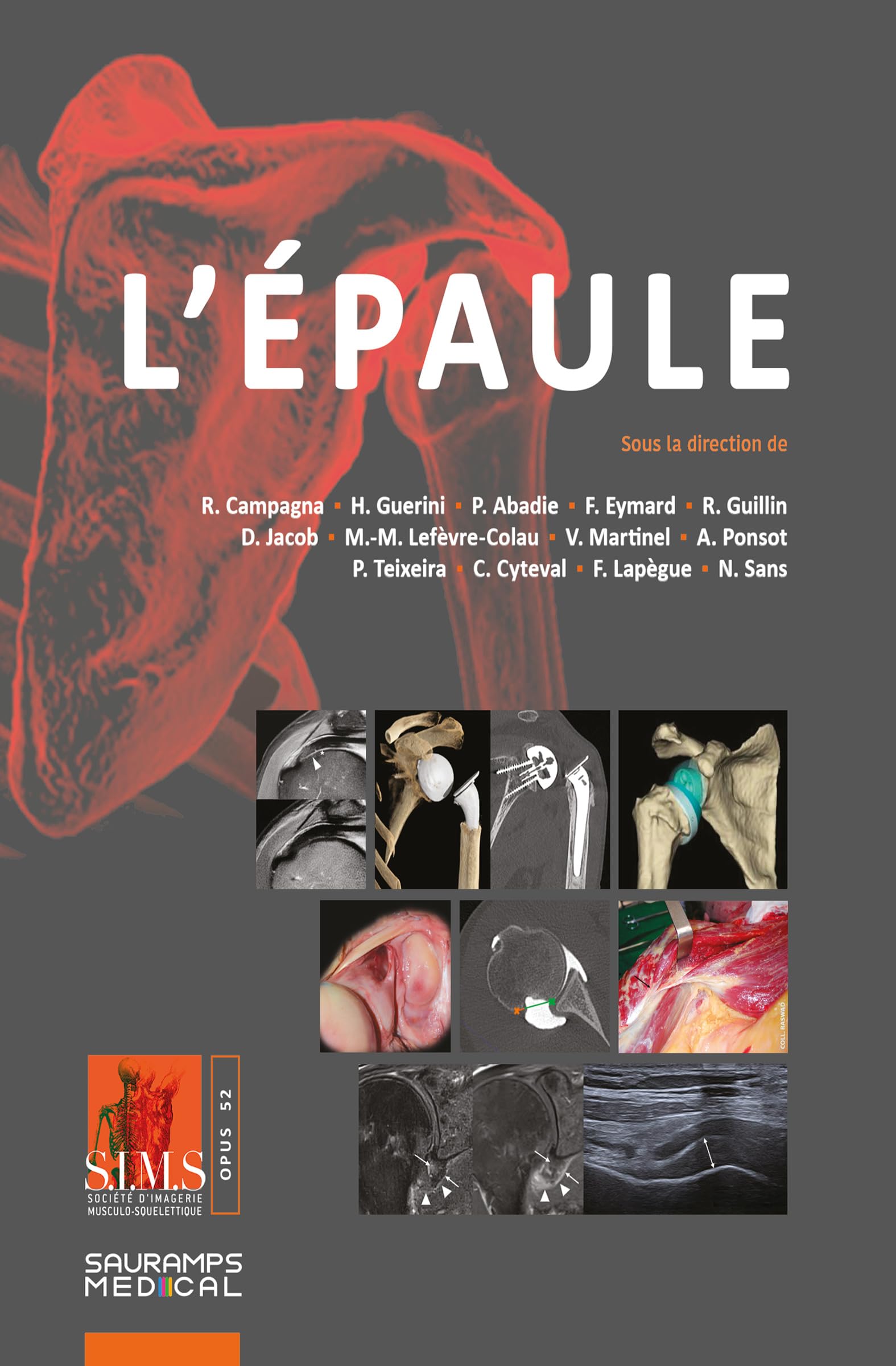 L'épaule - SIMS 2026
