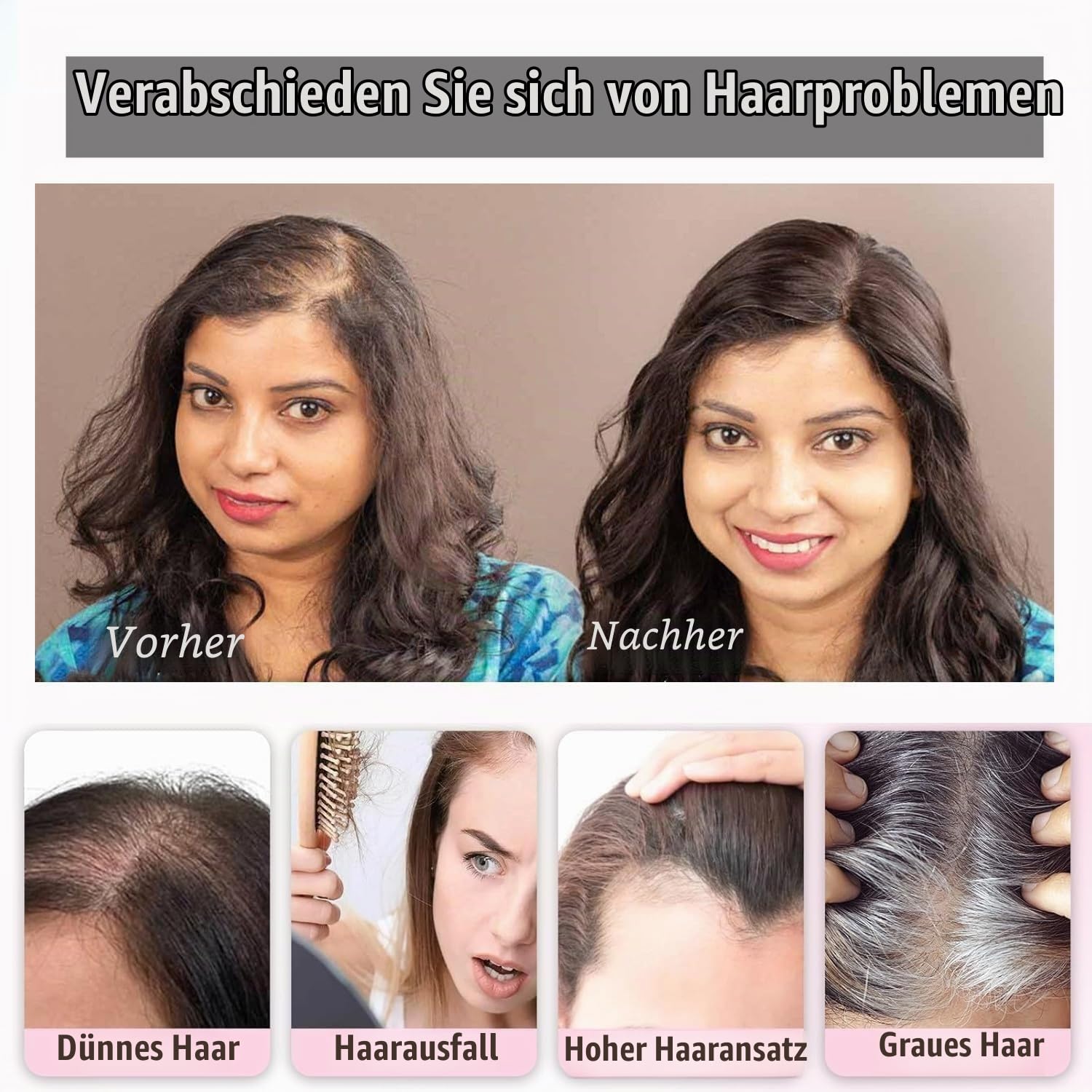 Braun Haarteile Für Dünnes Haar Haartopper Echthaar Oberkopf Damen 360°3D Cover Brown Human Hair Topper For Women Upgrade Lace Base Cilp In Hair Extensions gift For Her