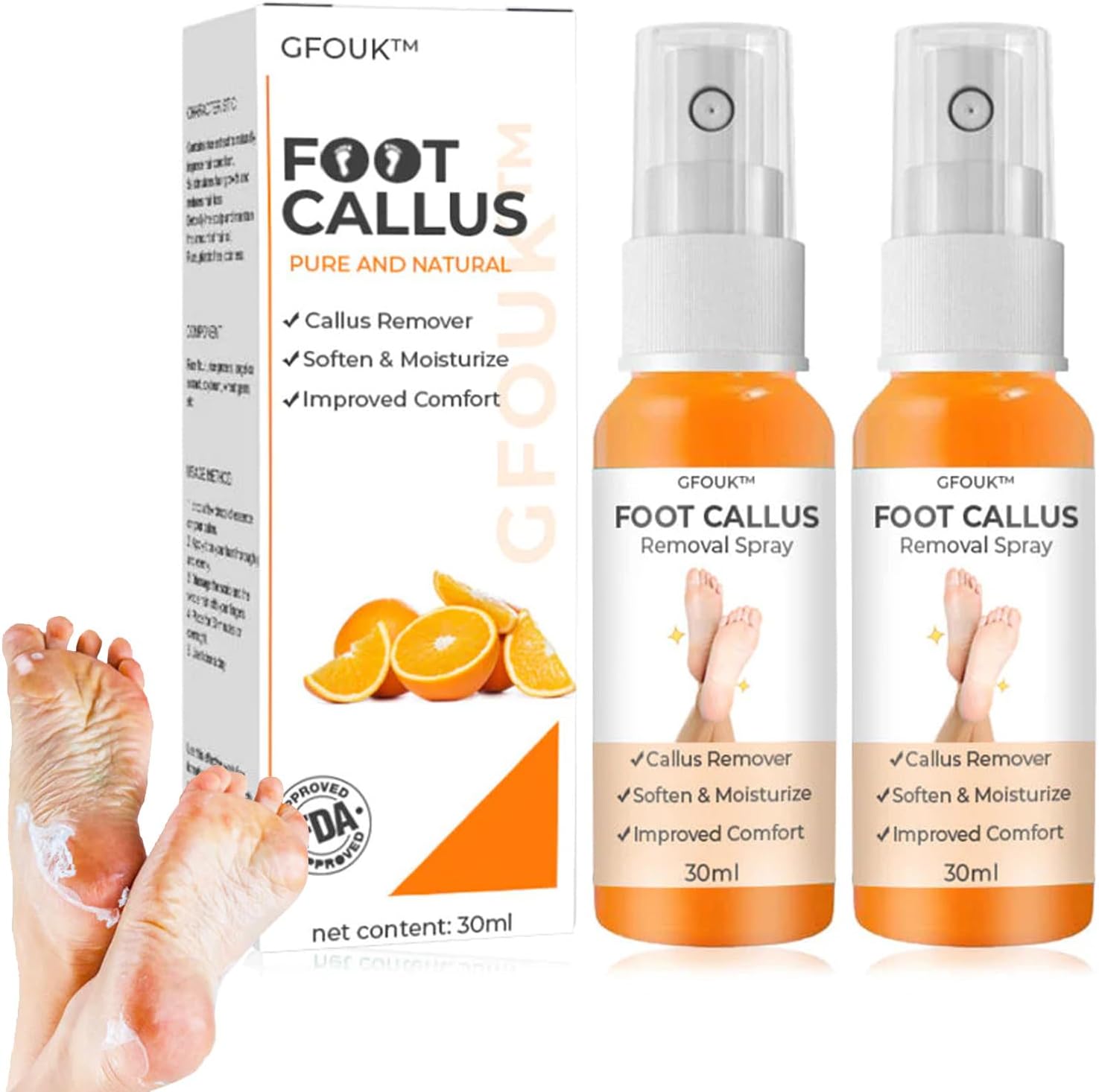 GFOUK Foot Callus Removal Spray, 30ml Foot Heel Callus Remover Spray