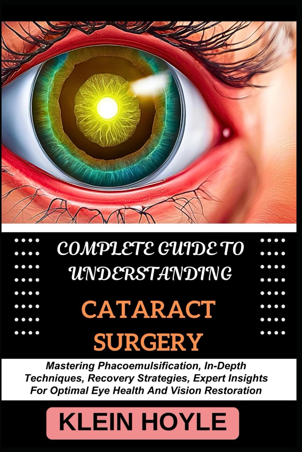 COMPLETE GUIDE TO UNDERSTANDING CATARACT SURGERY: Mastering Phacoemulsification, In-Depth Techniques, Recovery Strategies, Expert Insights For Optimal Eye Health And Vision Restoration