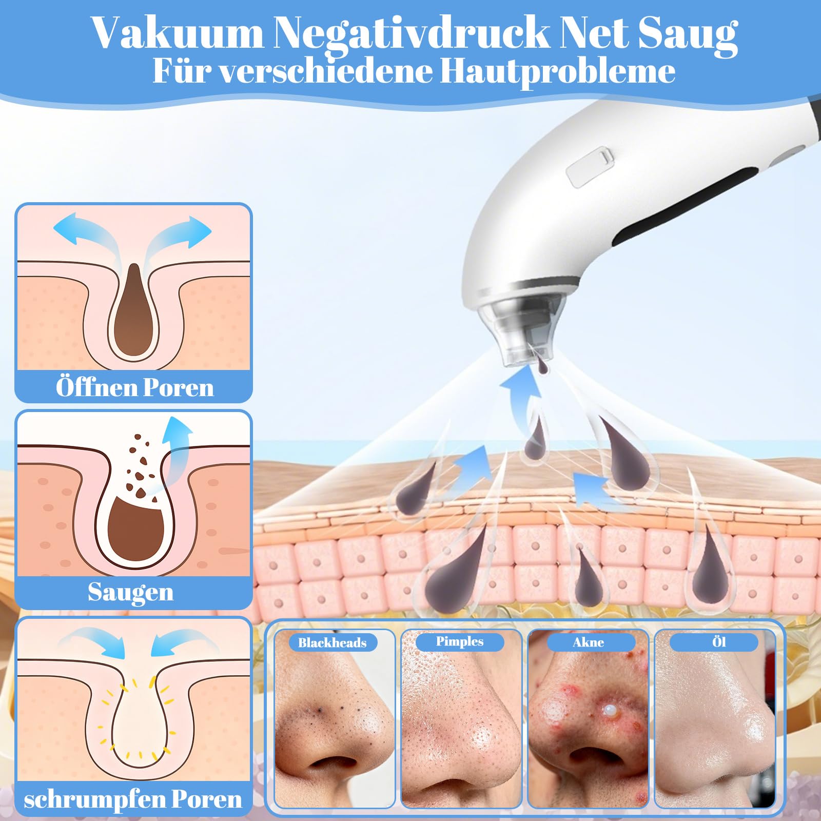Pulitore per i punti neri con serbatoio d'acqua visibile, 75 kPa forte assorbenza, 4 modalità e 6 accessori per la pulizia del viso, acne e punti neri, rimozione dei punti neri