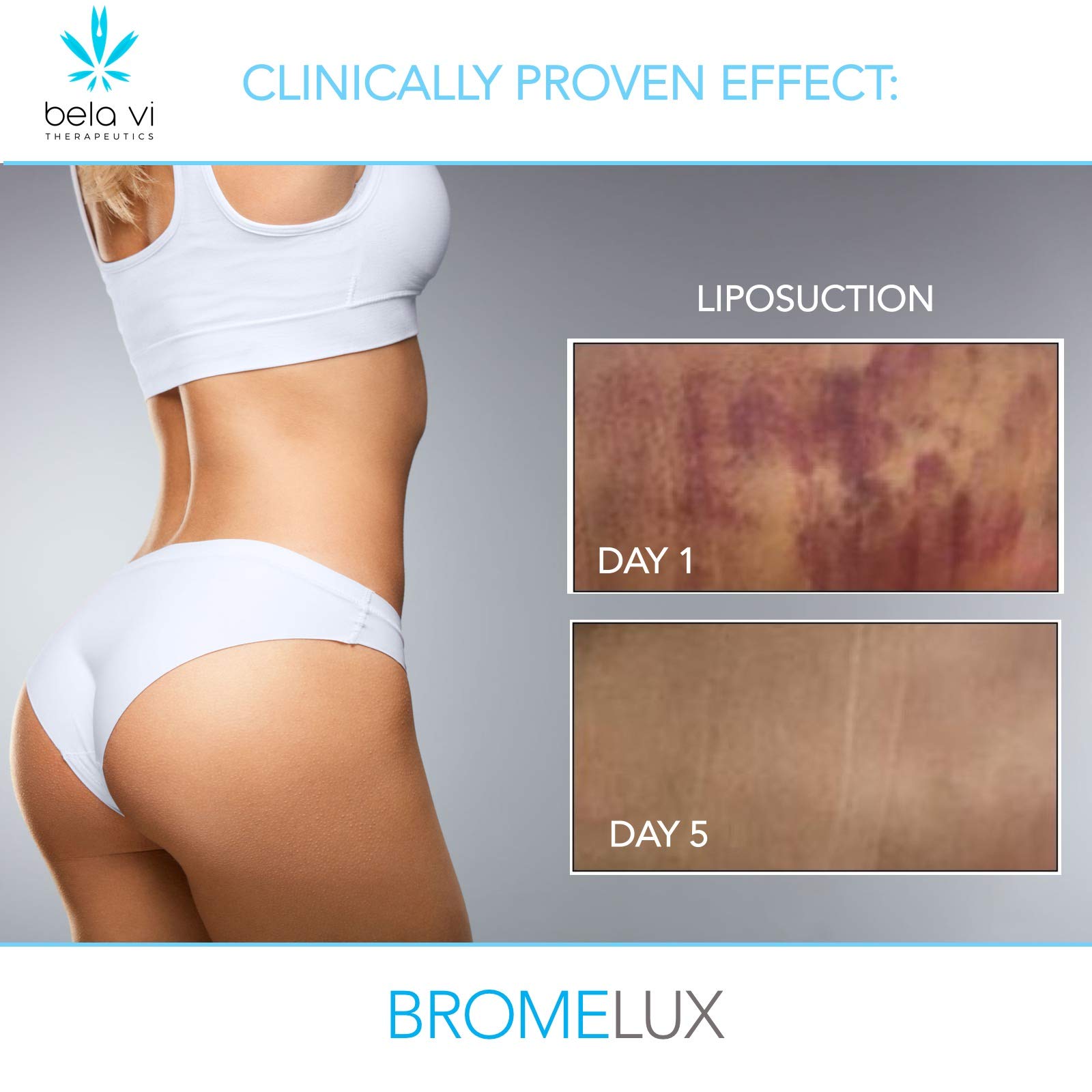 BROMELUX AntiBruising Supplement I Bromelain & Quercetin Complex