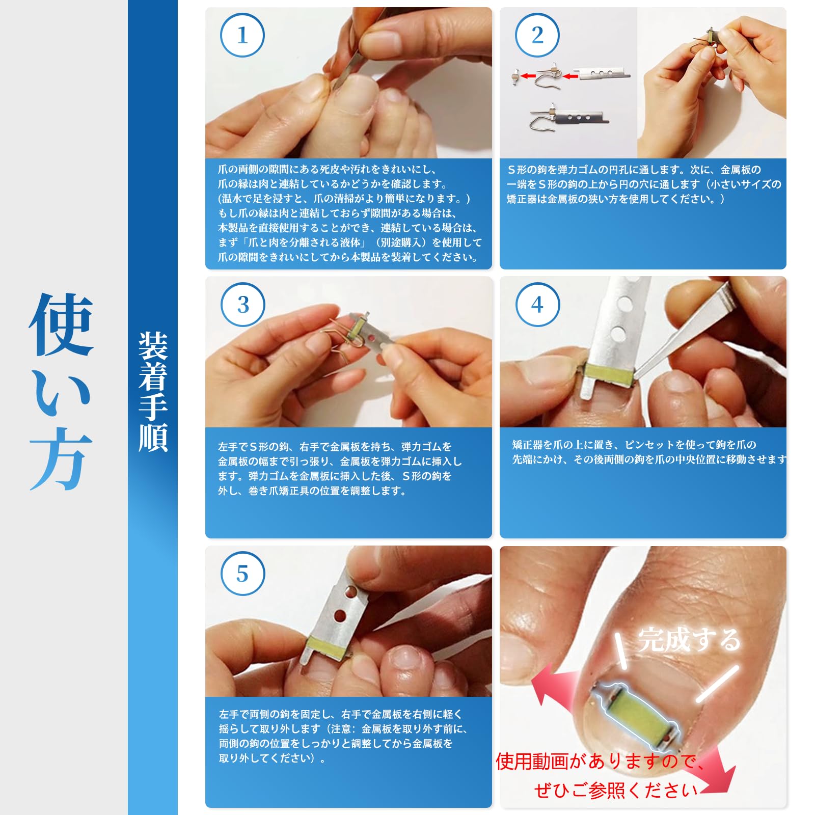 Amazon | 巻き爪器具 2個入り 巻き爪 まきづめ 陥入爪 まきずめ 巻爪