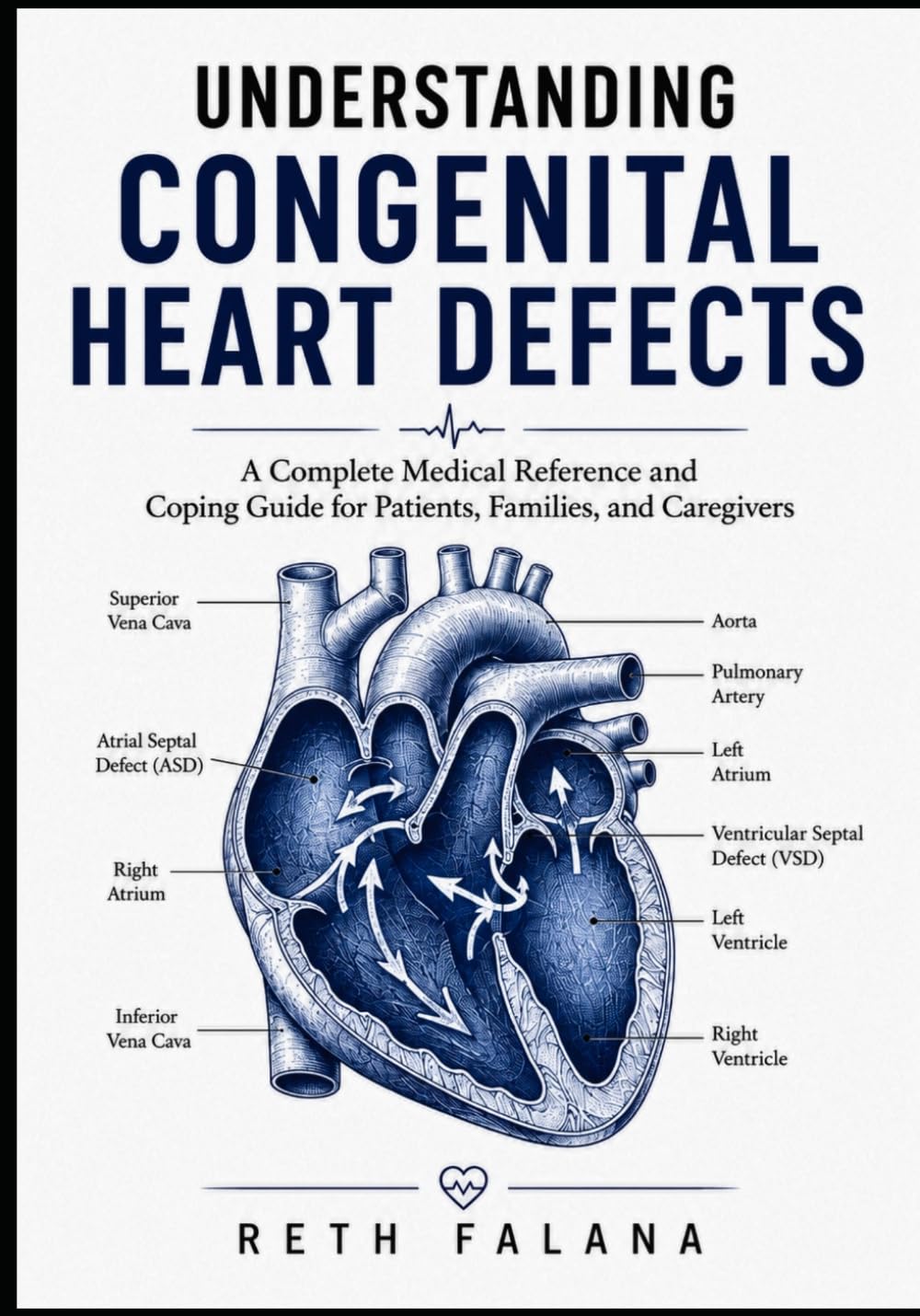 Understanding Congenital Heart Defects: A Complete Medical Reference and Coping Guide for Patients, Families, and Caregivers (The Cardiovascular Survival Guide Series: The Heart Conditions Explained)