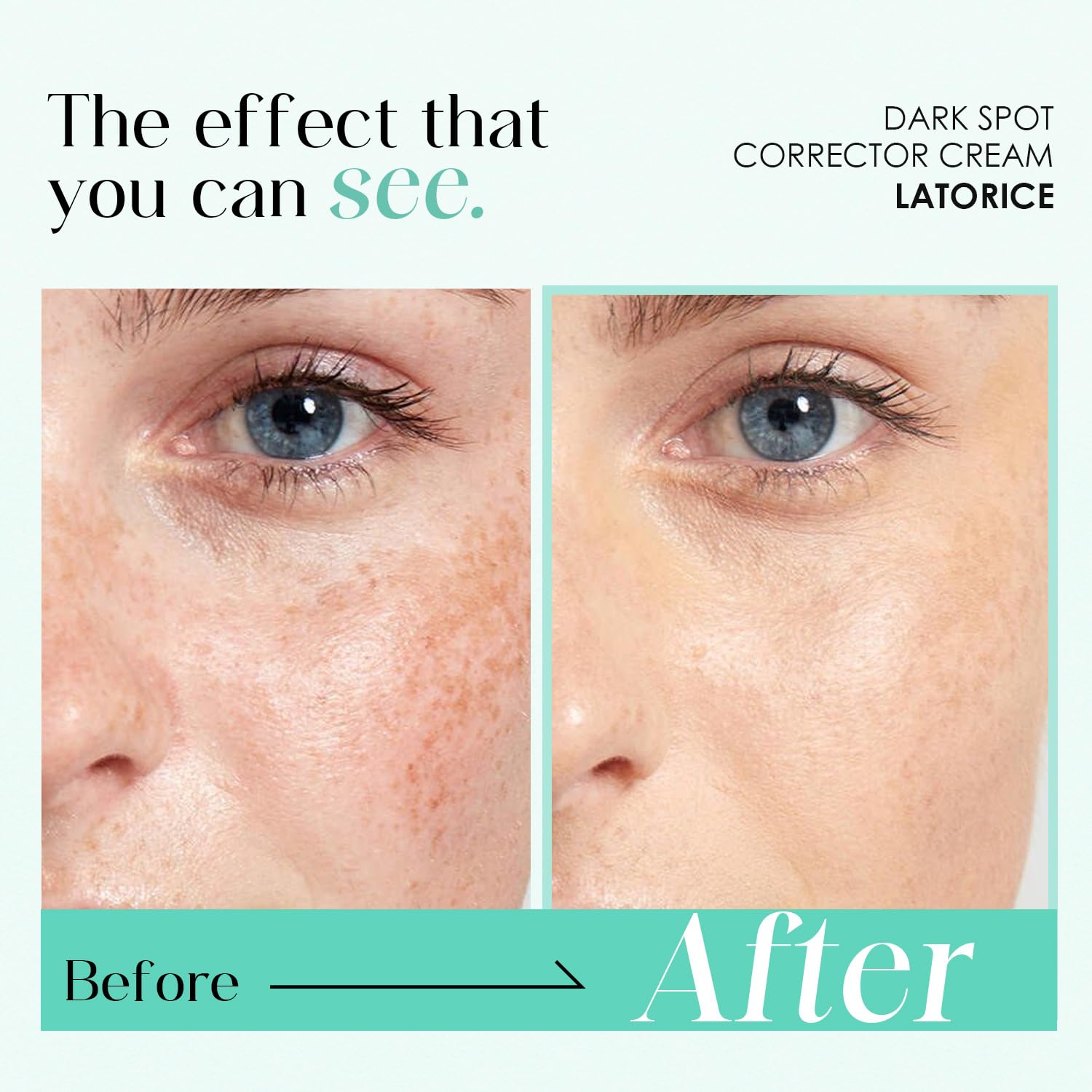 Dark Spot Remover for Face & Body: Dark Spot Corrector Cream for Sun Spot Melasma Freckles - Image 2
