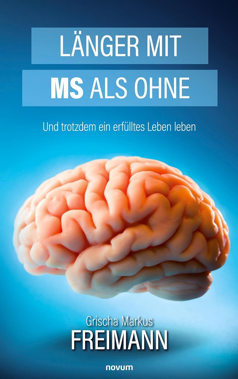 Länger mit MS als ohne: Und trotzdem ein erfülltes Leben leben