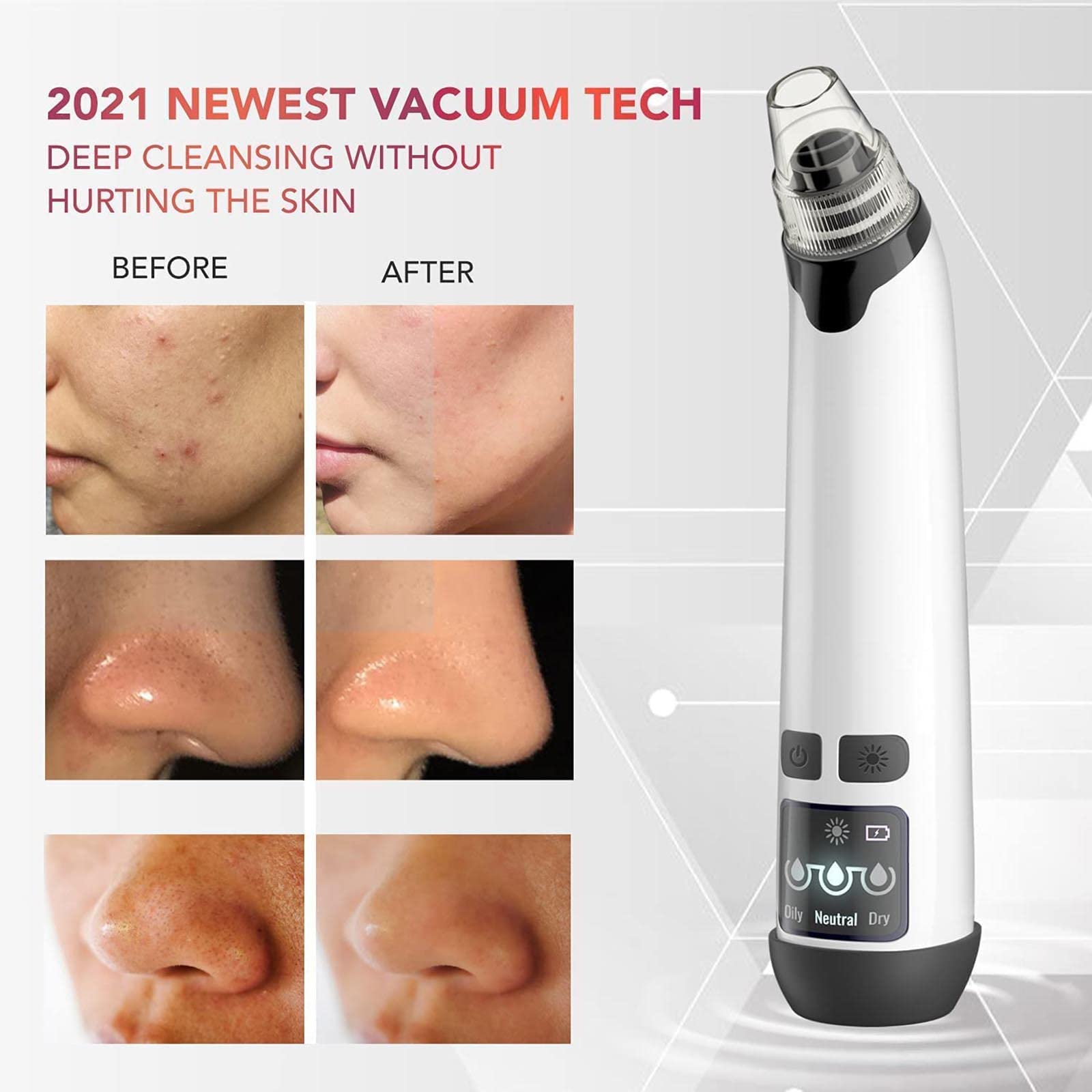 WolFum Herramienta de succión de puntos negros – Herramienta extractora de puntos blancos de comedones de acné, limpiador de poros facial eléctrico, limpiador de poros facial, removedor de puntos