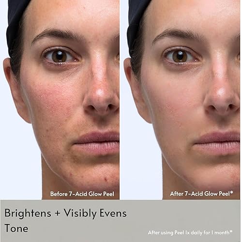 Miniatura 3 de Clarks Botanicals 7-Acid Daily Glow Peel AHA BHA Chemical Peel para cara, purifica los poros, regenera e ilumina la piel, todo tipo de piel, 4.2