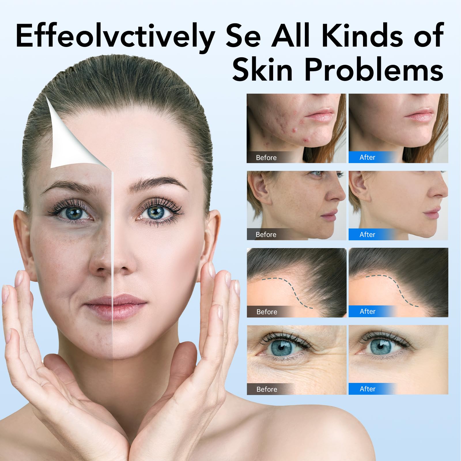Dr.Pen - Penna per microneedling A6 per viso e corpo, Derma Pen per siero cicatrici a 5 velocità di profondità, regolabile, con 2 batterie di riserva e 10 cartucce, con cavo a 36 pin e spina UK