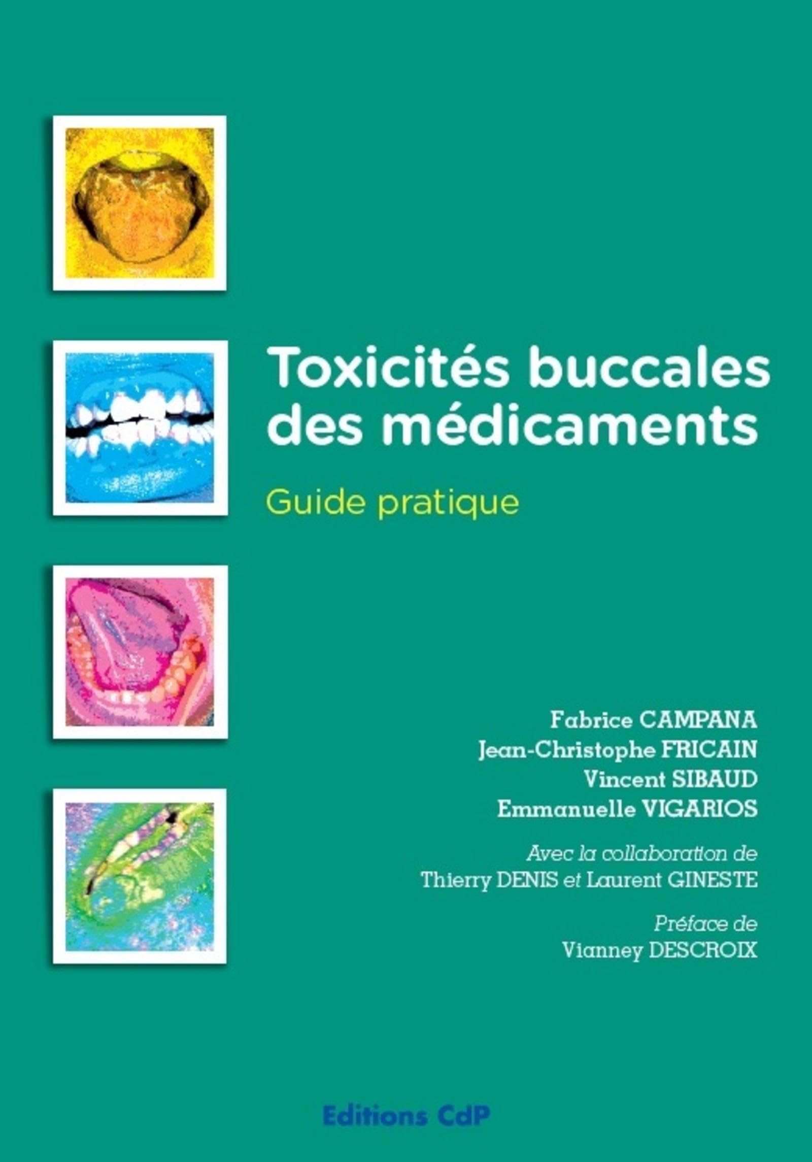 Toxicités buccales des médicaments: Guide pratique