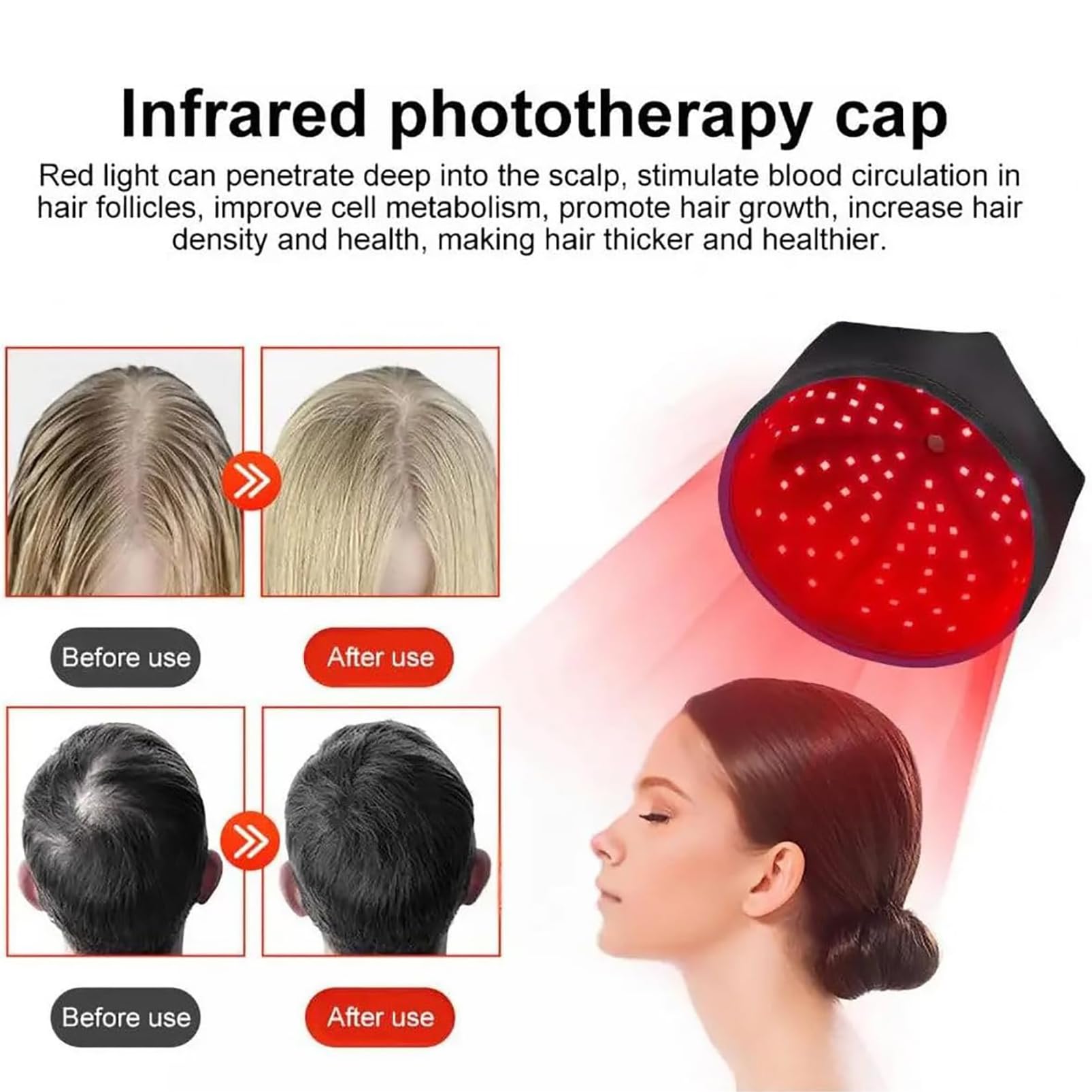 Bonnet De Croissance des Cheveux De Luminothérapie, Casque De Croissance des Cheveux, Bonnet De Photothérapie 120 LED 660nm Et 850nm, Améliore La Santé du Cuir Chevelu