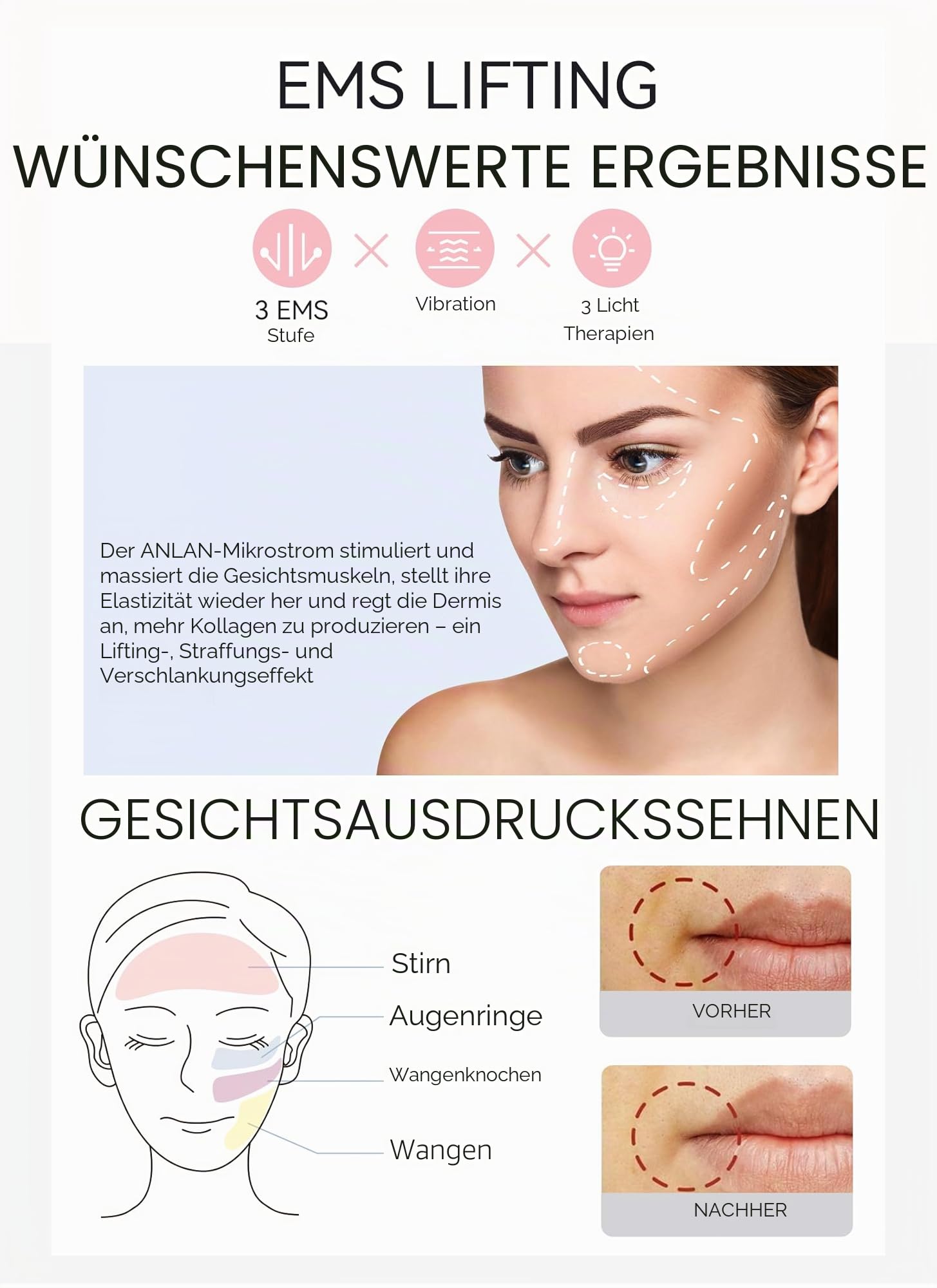 ANLAN 5in1 Gesichtsmassagegerät LED Lichttherapie Heat Cool Vibration EMS Anti Falten Anti Aging Gesichtsreinigung