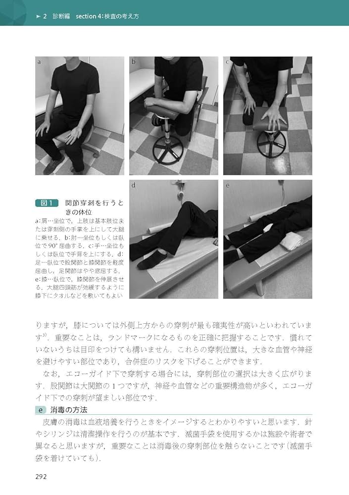 Amazon.fr - フィジカルアセスメントで追いつめる! リウマチ