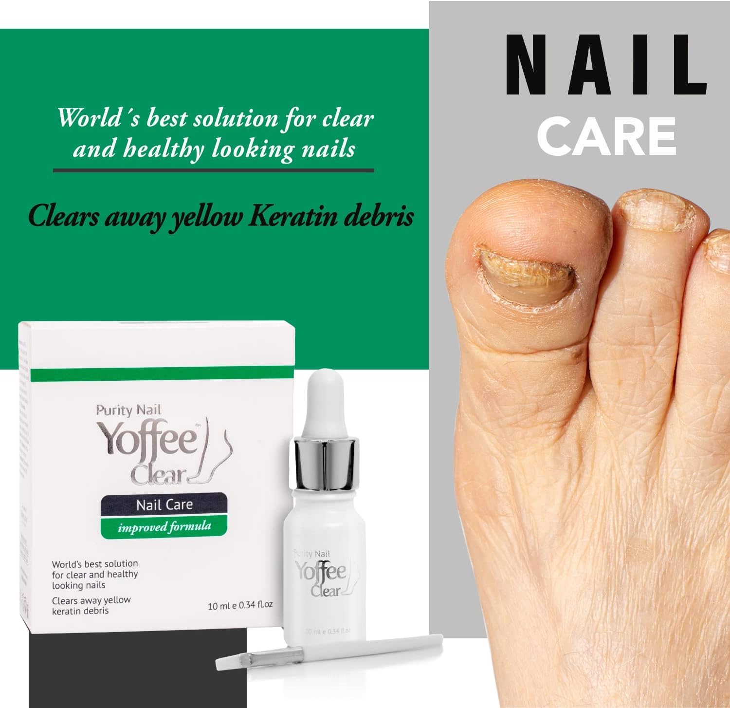 Simon & Tom Yoffee Clear Premium Nail Fungal Treatment with Argan Oil. 10 ml