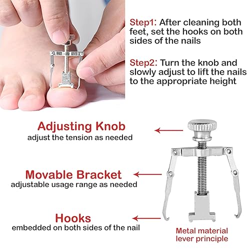 Miniatura 5 de Queenme Podólogo Kit de eliminación de uñas encarnadas profesional resistente para dedos gruesos para personas mayores y hombres, herramientas de