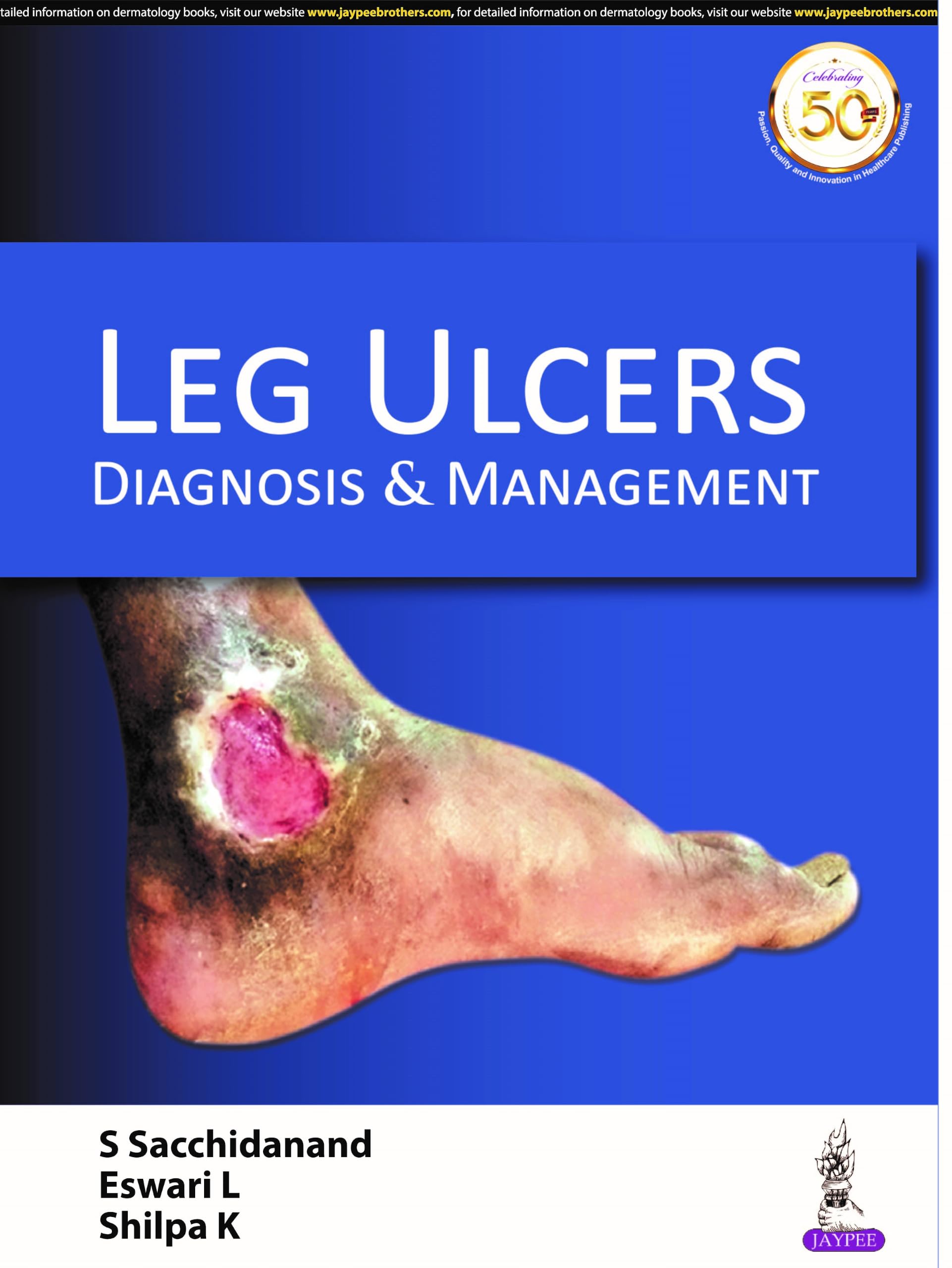 Leg Ulcers: Diagnosis & Management