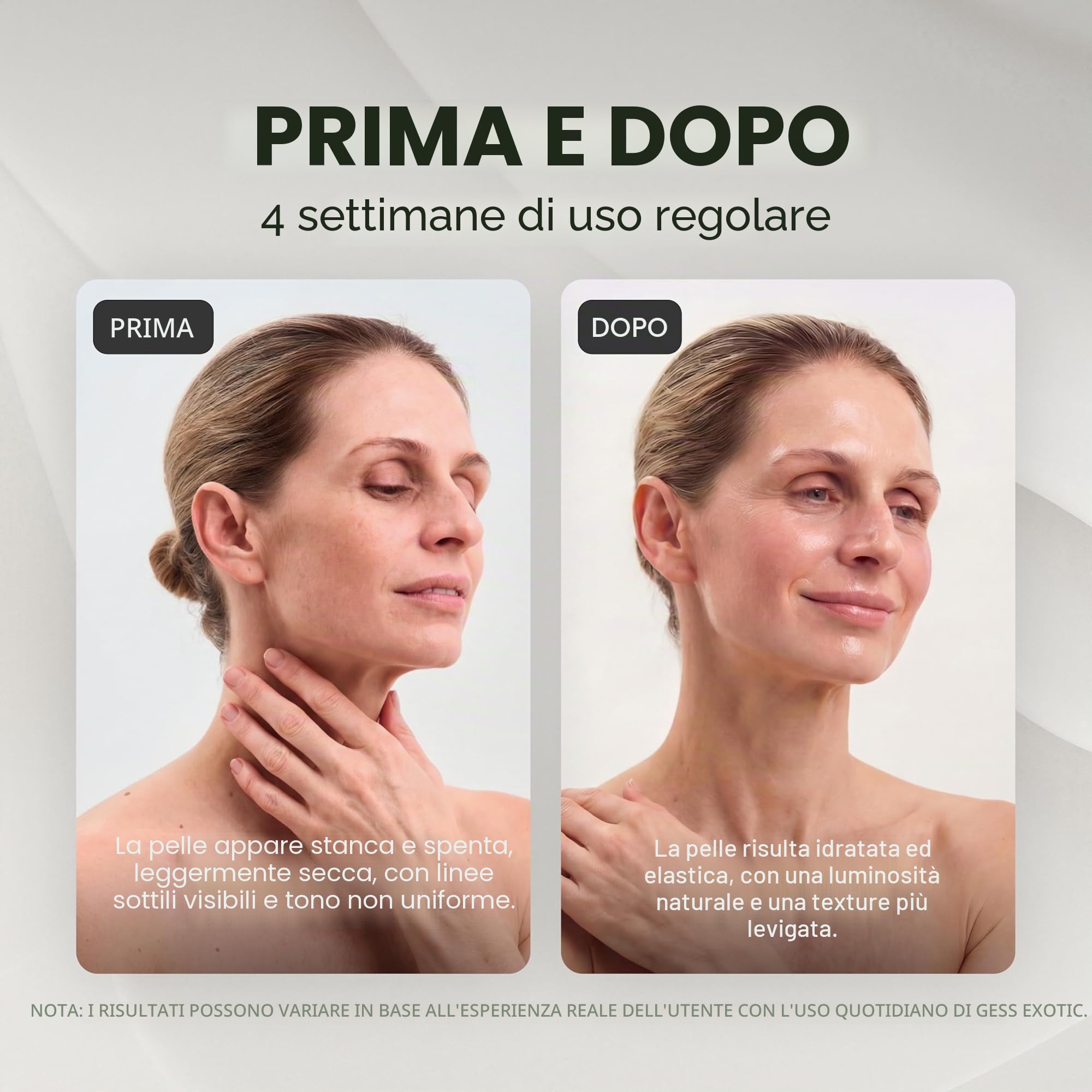 GESS Exotic Pulizia Viso Ultrasuoni Originale, 5 modalità, Ultrasonic Skin Scrubber - Dispositivo Professionale per Pulizia Viso a Ultrasuoni, Sonic Spatola Punti Neri