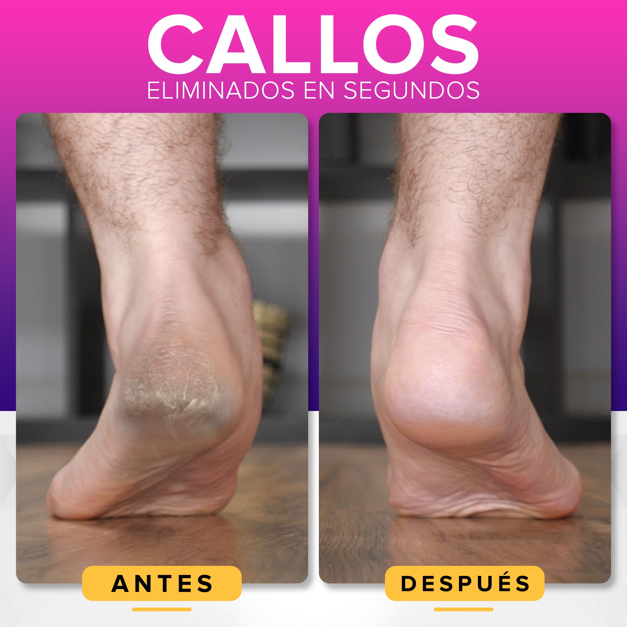 Lima Pies Durezas A PRUEBA DE ÓXIDO Con Recogedor (Tamaño XL) NYK1 MEGAFILE Removedor De Callos Para Uso En Seco Y Húmedo - Quita Durezas para Pies De Alto Rendimiento Con Agarre Antideslizante
