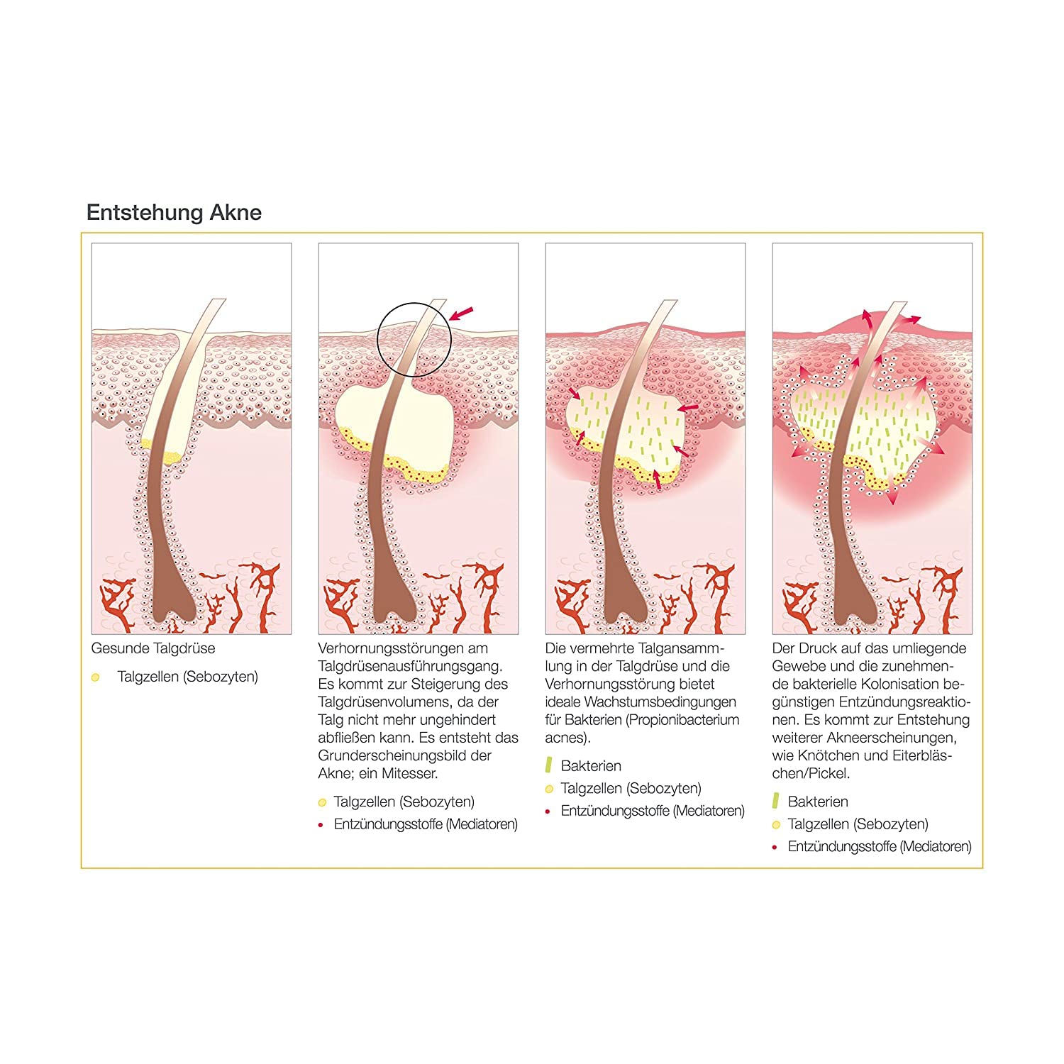 AESTHETICO clarify skin - Mattierende Feuchtigkeitspflege f?r Mischhaut, fettige Haut und Akne, Gelcreme mit Salizylsubstanzen (5 x 50 ml), 1, 250.0 milliliter