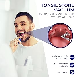 Oravix Tonsil Stone Vacuum, Tonsil Stone Remover Vacuum Suction, Tonsil Stone Cupping Tool, Tonsil Stone Removal Tool with Suction, Tonsil Stones Removal Vacuum, Tonsil Stone Extractor - 3 in 1 Kit