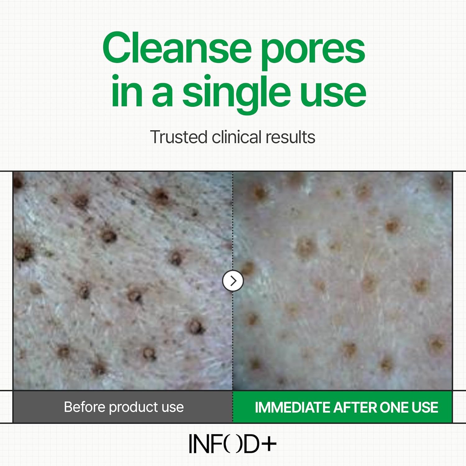 INFODPLUS XCESPI316 Gel Cleanser – Exosome & Walnut Powder Foaming Face Wash for Deep Pore Cleansing, Oil Control & Blackhead Care | Korean Cleanser for Men & Women, 100ml - Image 7