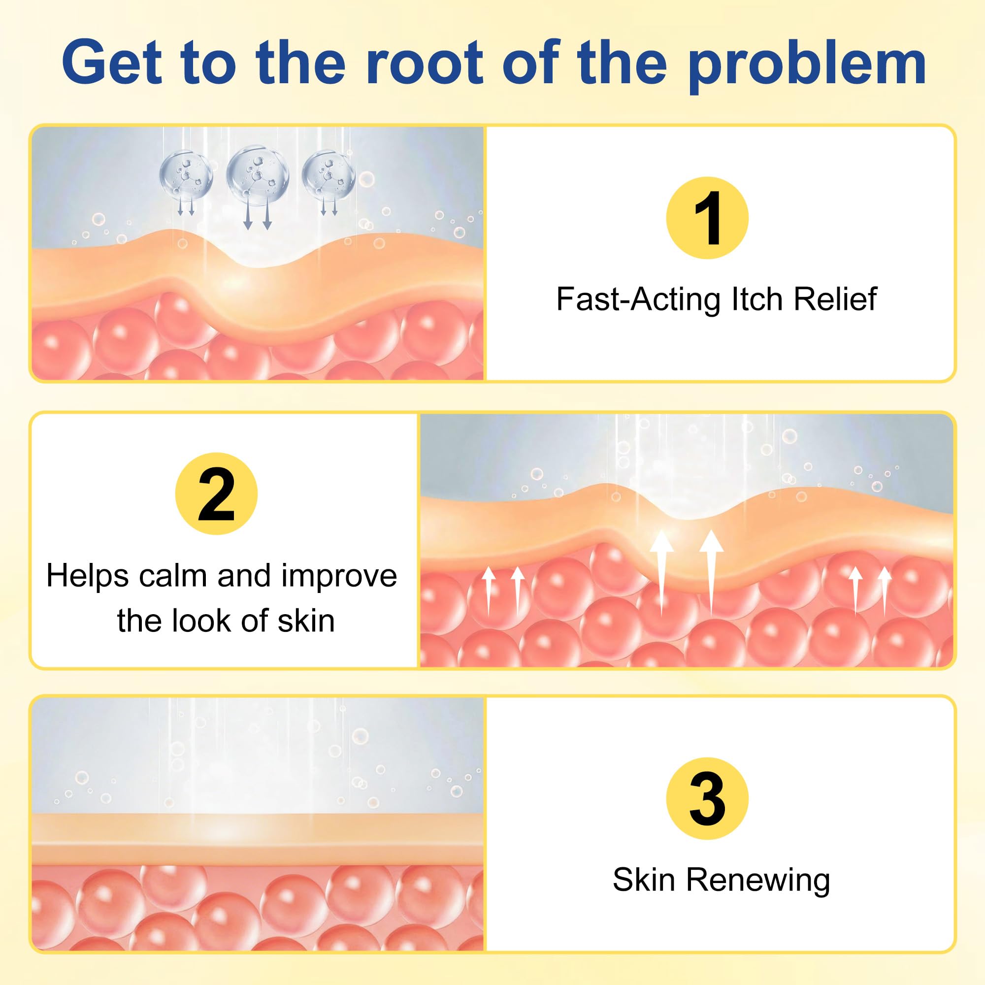 Psoriasis Cream, Natural Seborrheic Dermatitis Relief for Itchy Flaky Skin, Soothing Ointment for Redness & Scaling 20g - 4