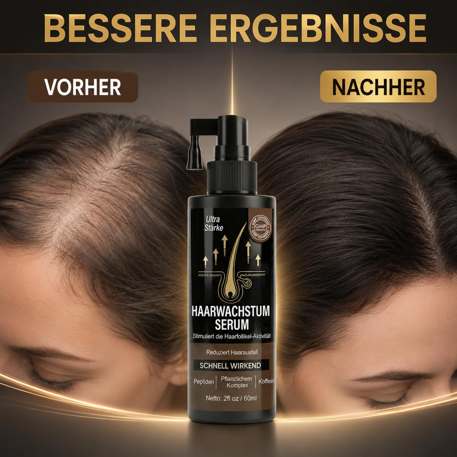 Hair Growth Spray, 60 Ml Haarwachstumsspray für Frauen & Männer, das Haarwachstum Beschleunigt, Haarwachstum Serum für Haardicke und Pflege, Spray Design Frisch Nicht Fettig