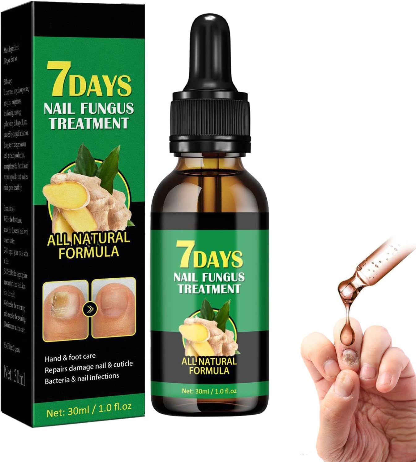 Ginger Nail Treatment Nail Support Nail Care, 7 Days Nail Treatment,Ginger Nail Growth Serum, Ginger Nail Treatment, Ginger Cuticle Care Oil for Damaged Nails (1pcs, 30ml)