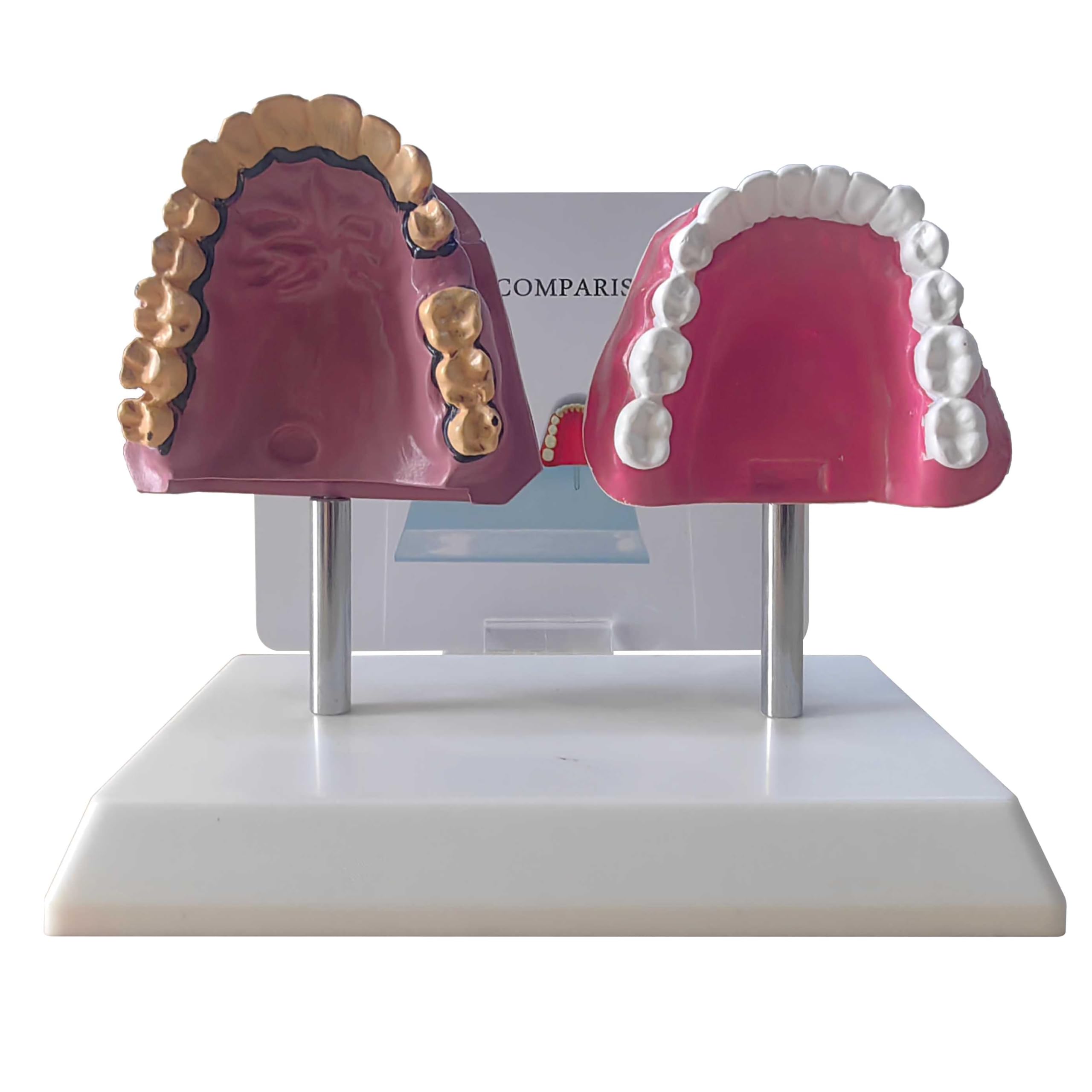 KDJFS Smokers Teeth Model and Healthy Teeth Model Life Size Human Tooth Anatomy Model with Pathological Features and Accurate Anatomy Structure for Emonstrate the Effects of Smoking on Tooth Health