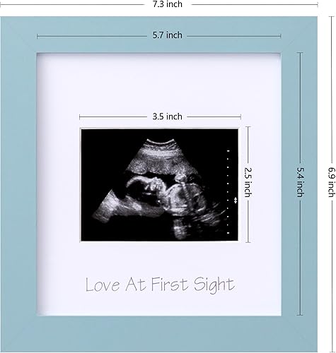Miniatura 3 de eletecpro Sonogram - Portarretratos con ultrasonido de 3 x 4, marcos de fotos de ultrasonido para anuncio de embarazo, regalos únicos para mujeres