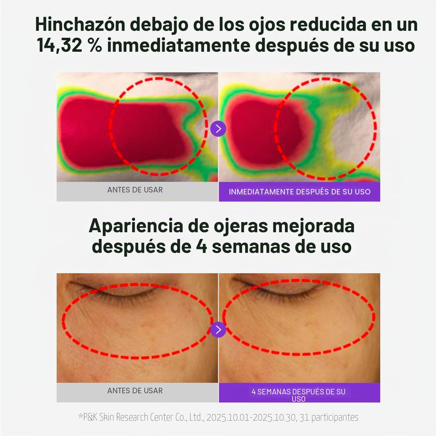 CENTELLIAN 24 360 Shot PDRN - Parche brillante para los ojos (6 juegos, 12 unidades) – Parches de hidrogel revitalizante instantáneo y revitalizante de círculos oscuros debajo de los ojos con PDRN
