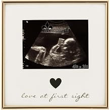 5x3 Sonogram - Ultrasound Gold Metla Picture Frame - Love at First Sight Design