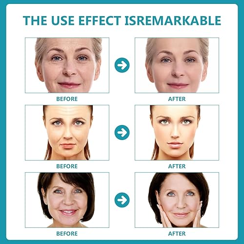 Miniatura 4 de Zikkeeda Suero facial Botox de 2 piezas, Esencia de péptido Cono 84% suero antiarrugas, reduce la pigmentación, Botox en una botella, ajuste