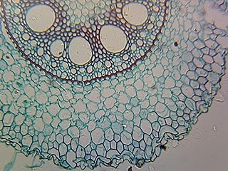 Angiosperms Roots - Microscope Slide