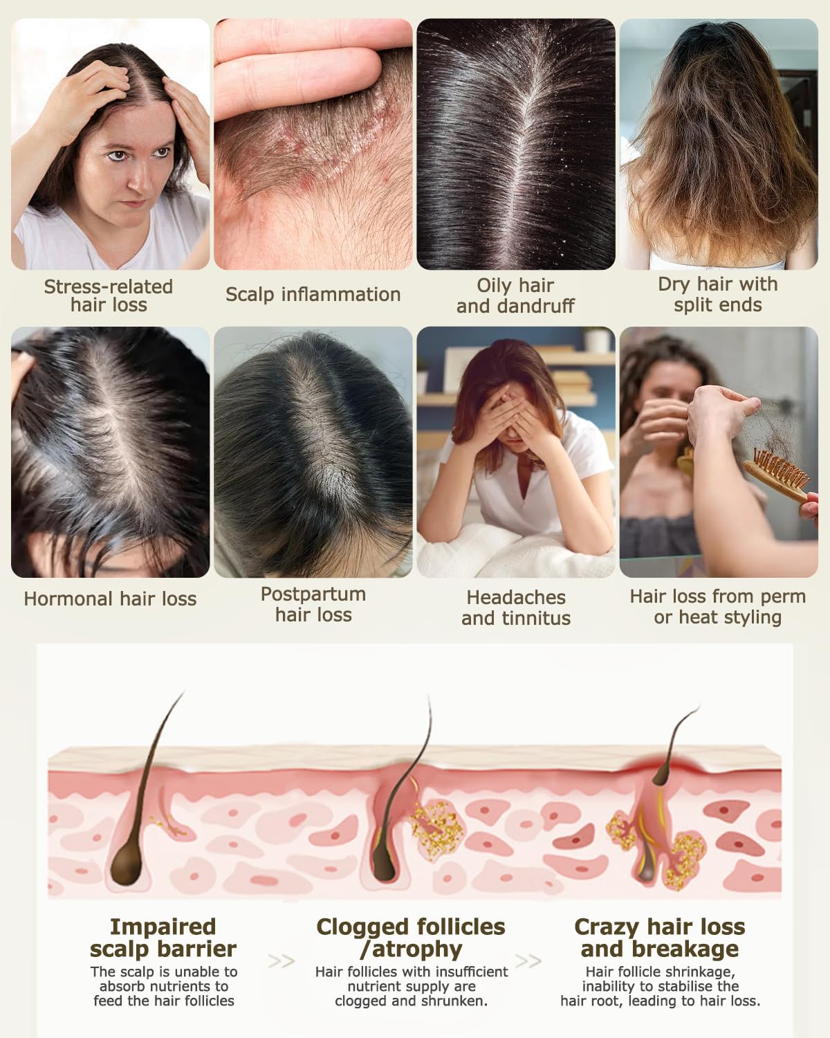 LLLT Haarwuchs Kamm-Rotlicht Therapie Haarbürste gegen Haarausfall mit 630nm Infrarot & 850nm Infrarotlicht & 460nm Blaulicht Grünes Lich–RF EMS Ionen Haarpflege Massagegerät für Männer & Frauen