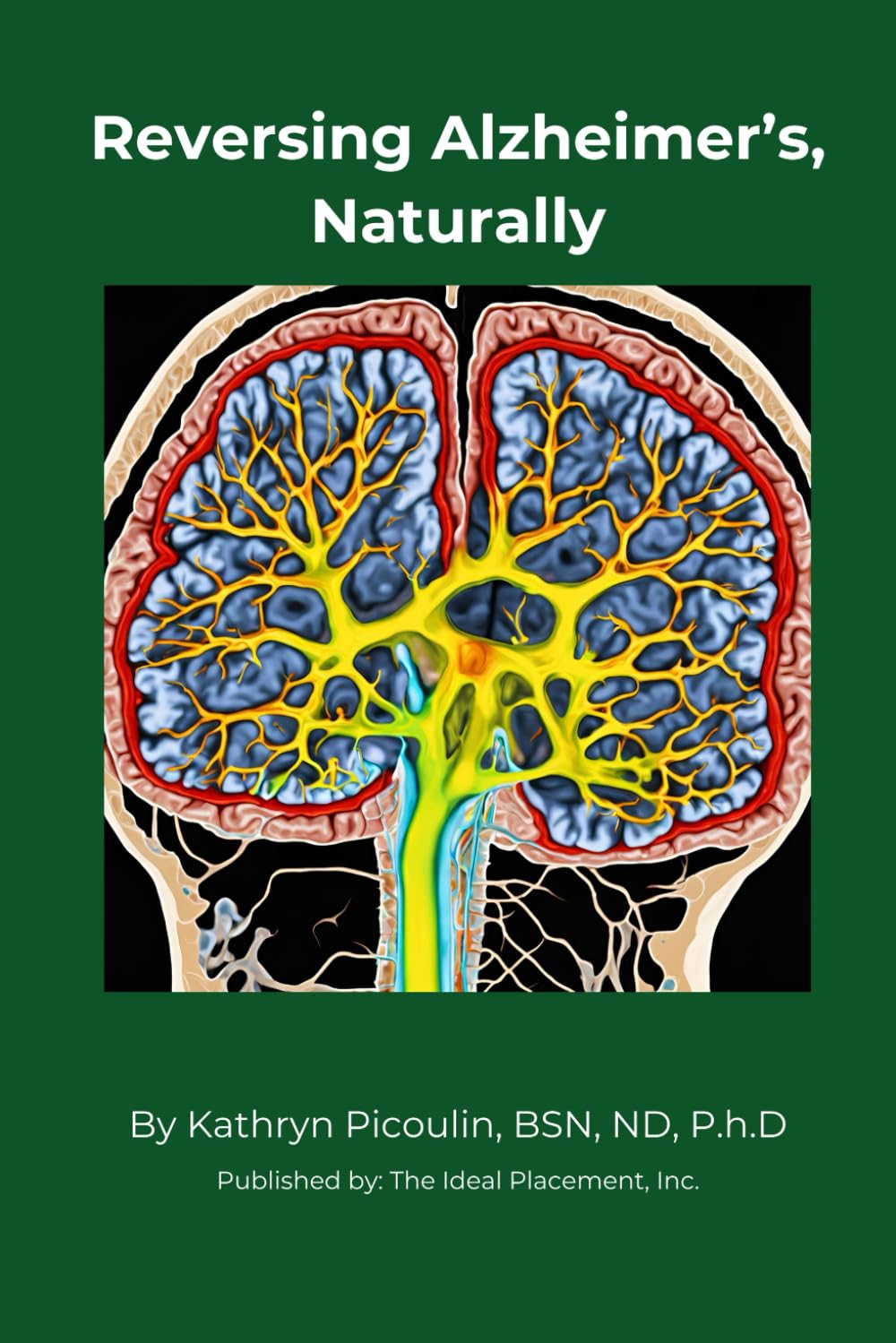 Reversing Alzheimer’s, Naturally