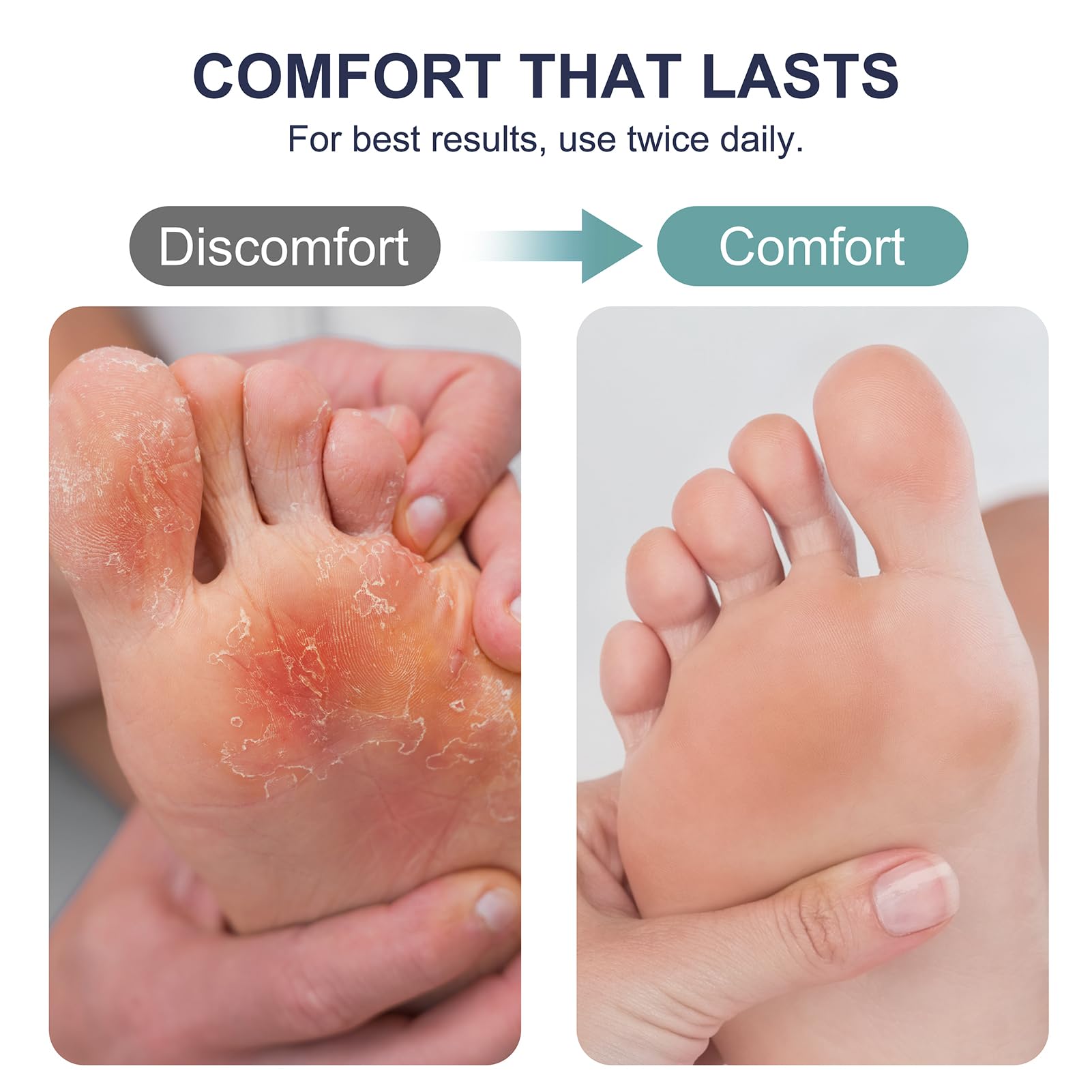 Antifungal Cream for Athlete’s Foot, Jock Itch - 1% Clotrimazole — Amazon image 4