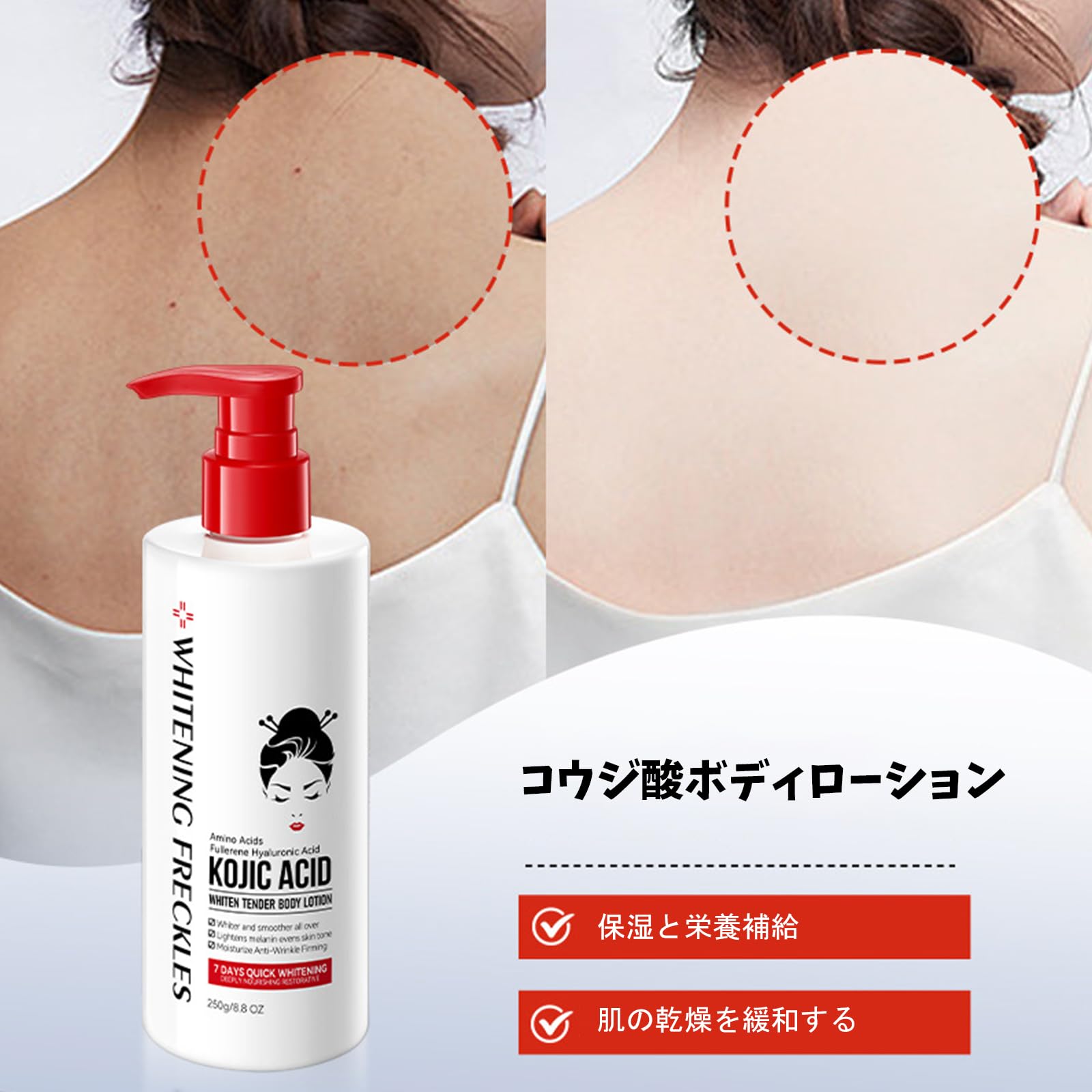 Amazon | Xnuoyo コウジ酸(麹酸)配合 高保湿ボディミルク 美白 全身用