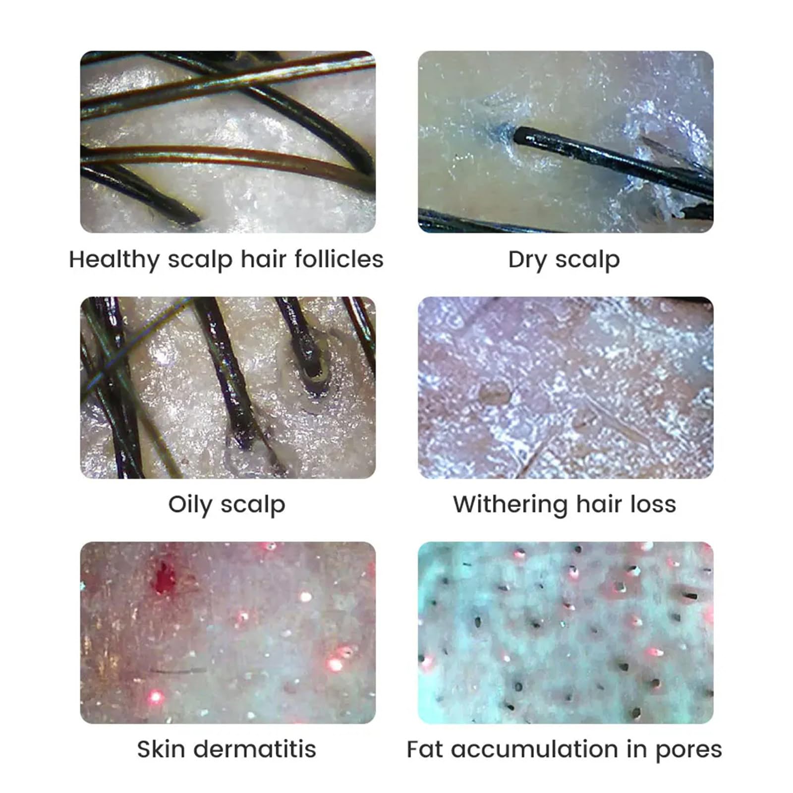 Jootoo Dermatoscopio Wireless Analizzatore della Pelle del Cuoio capelluto Macchina 1000X Analizzatore Viso e Corpo Microscopio elettronico Professione Sanitaria di Bellezza